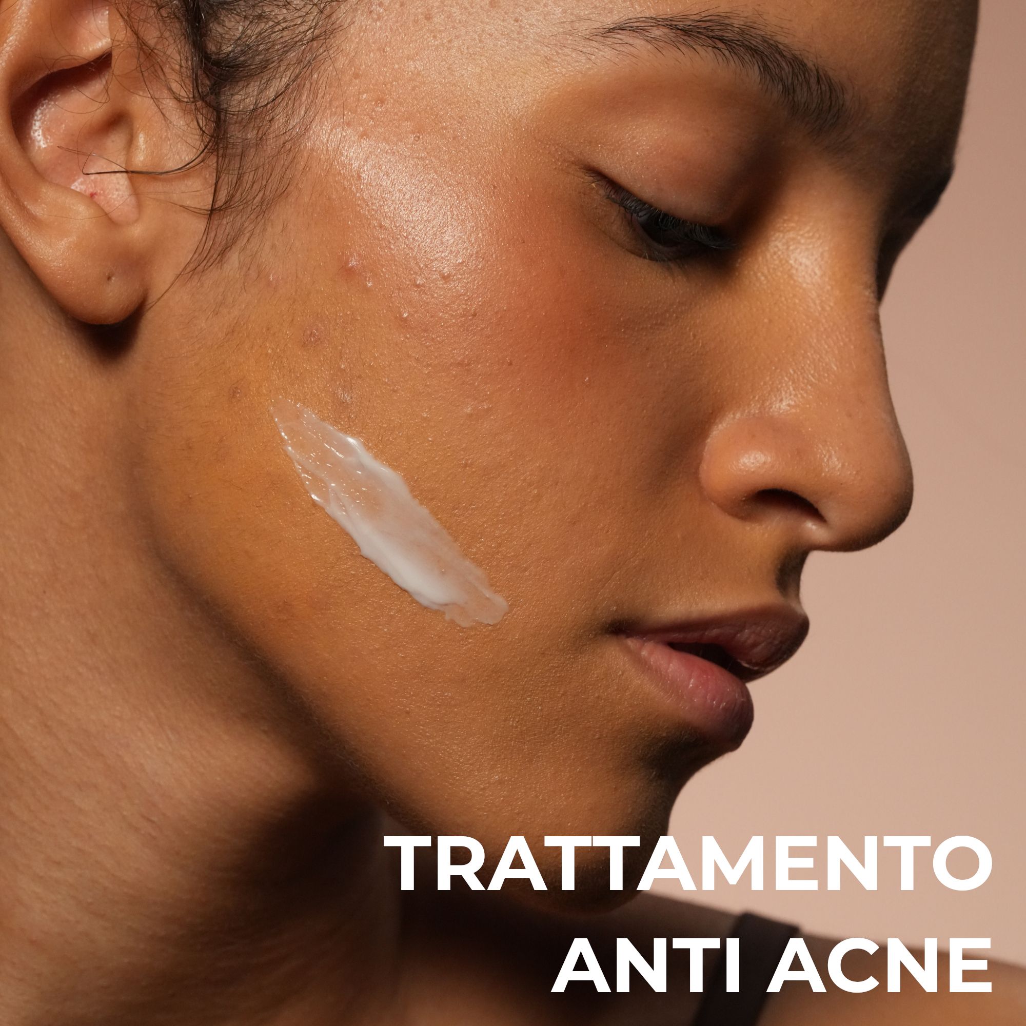 Alkemy Gezichtscrème tegen puistjes, Anti-acne behandeling, vermindert puistjes