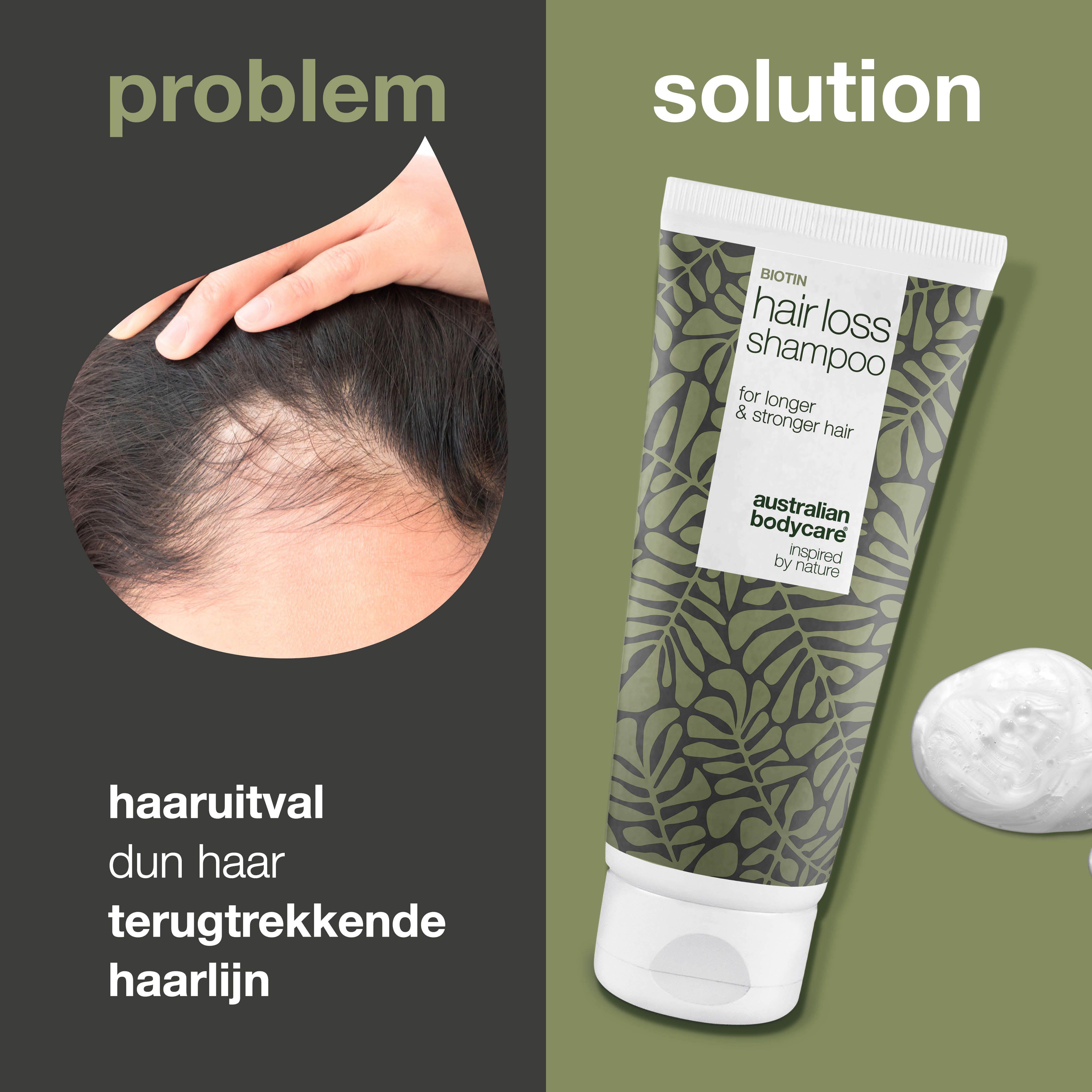 Biotin Hair Loss Shampoo tube. Groen-wit ontwerp. Tekst: Hair Loss Shampoo, Australian Bodycare.