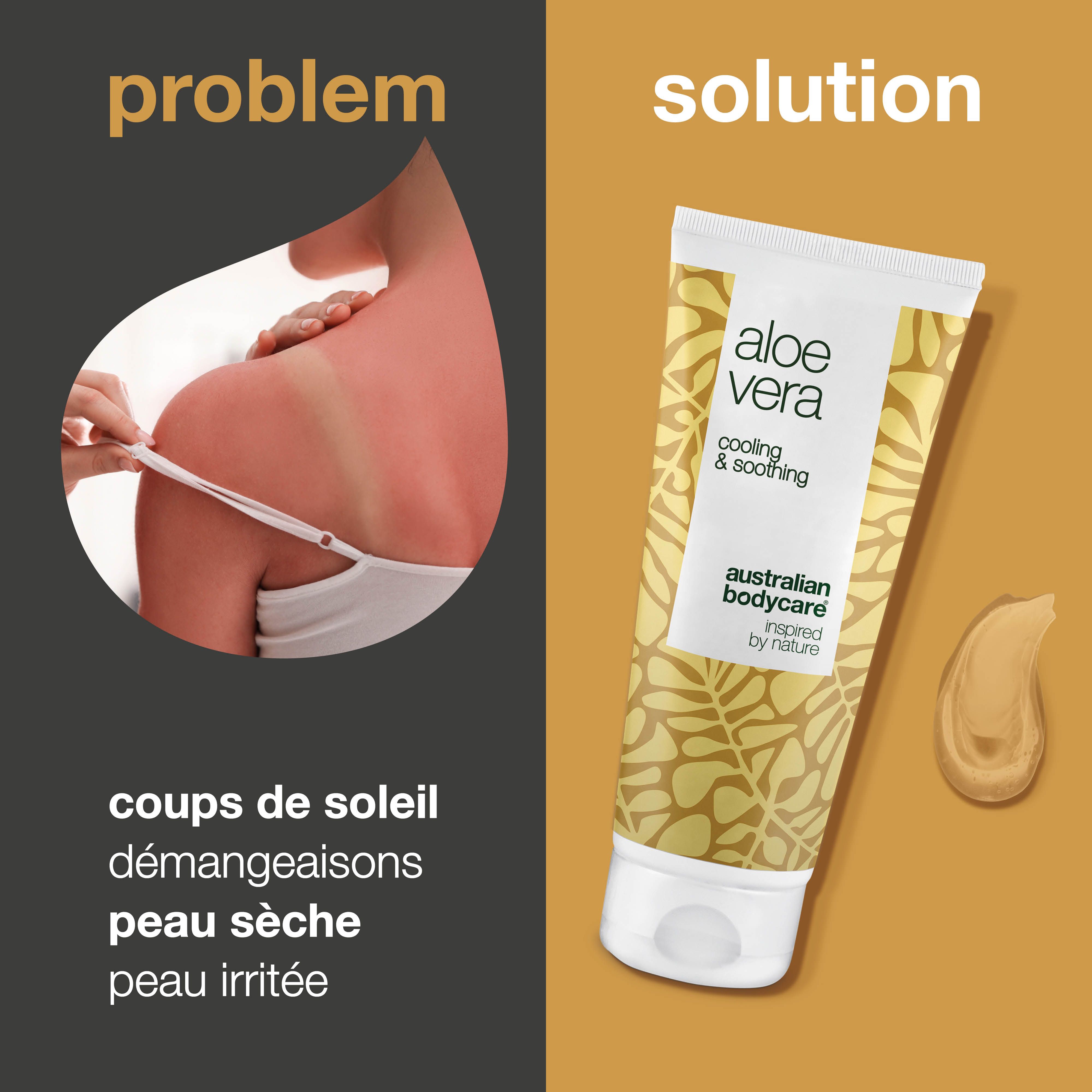 Comparaison : coup de soleil vs. gel d'aloe vera. Tube Aloe Vera, texte : cooling & soothing, Australian Bodycare.
