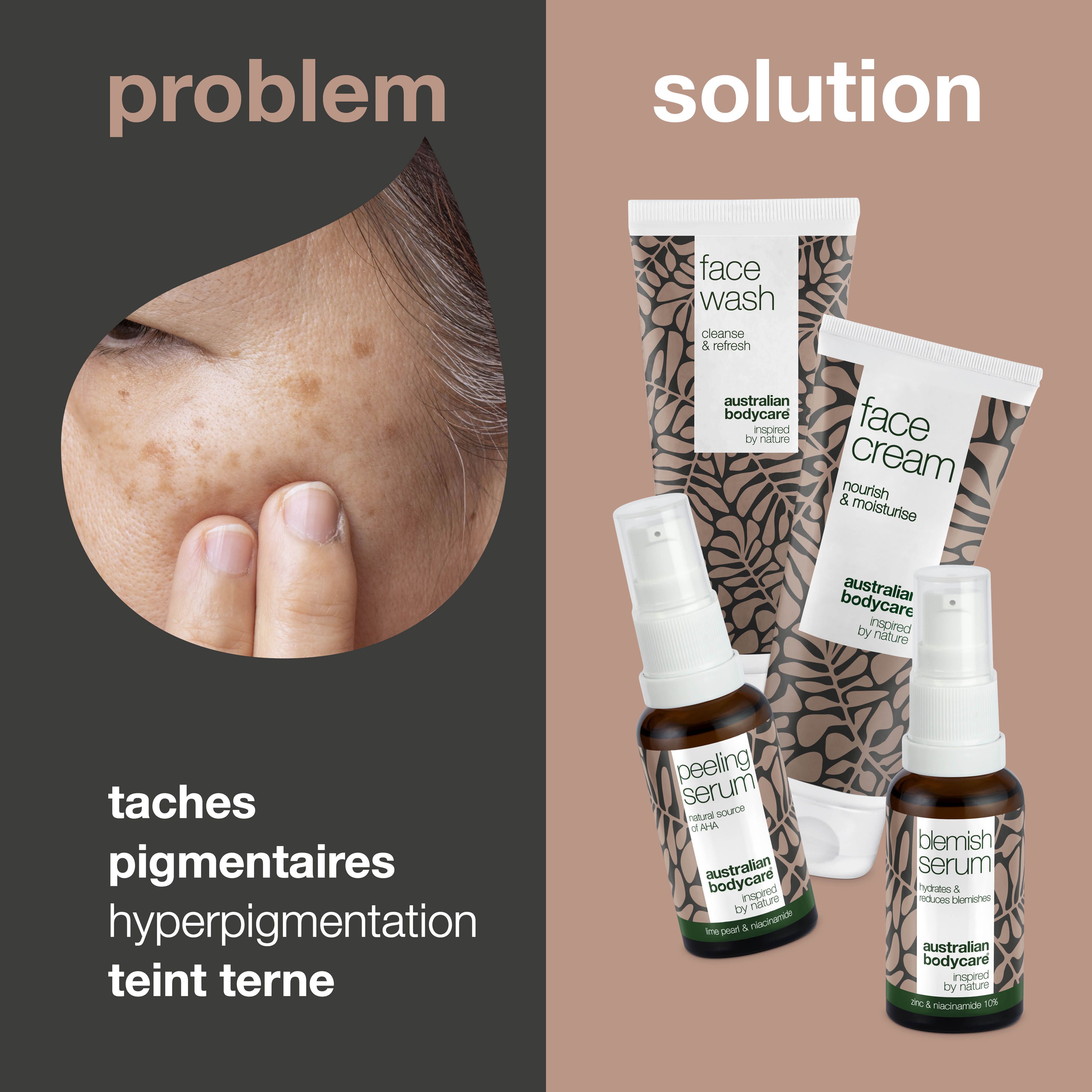 Visage avec taches pigmentaires. À côté, les produits Face Wash, Face Cream, Peeling Serum et Blemish Serum.