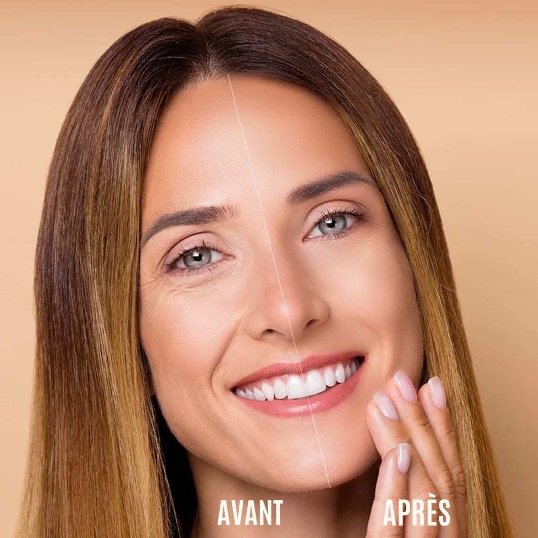 Comparaison avant-après. Femme avec rides, puis peau lisse. Texte : Avant, Après.
