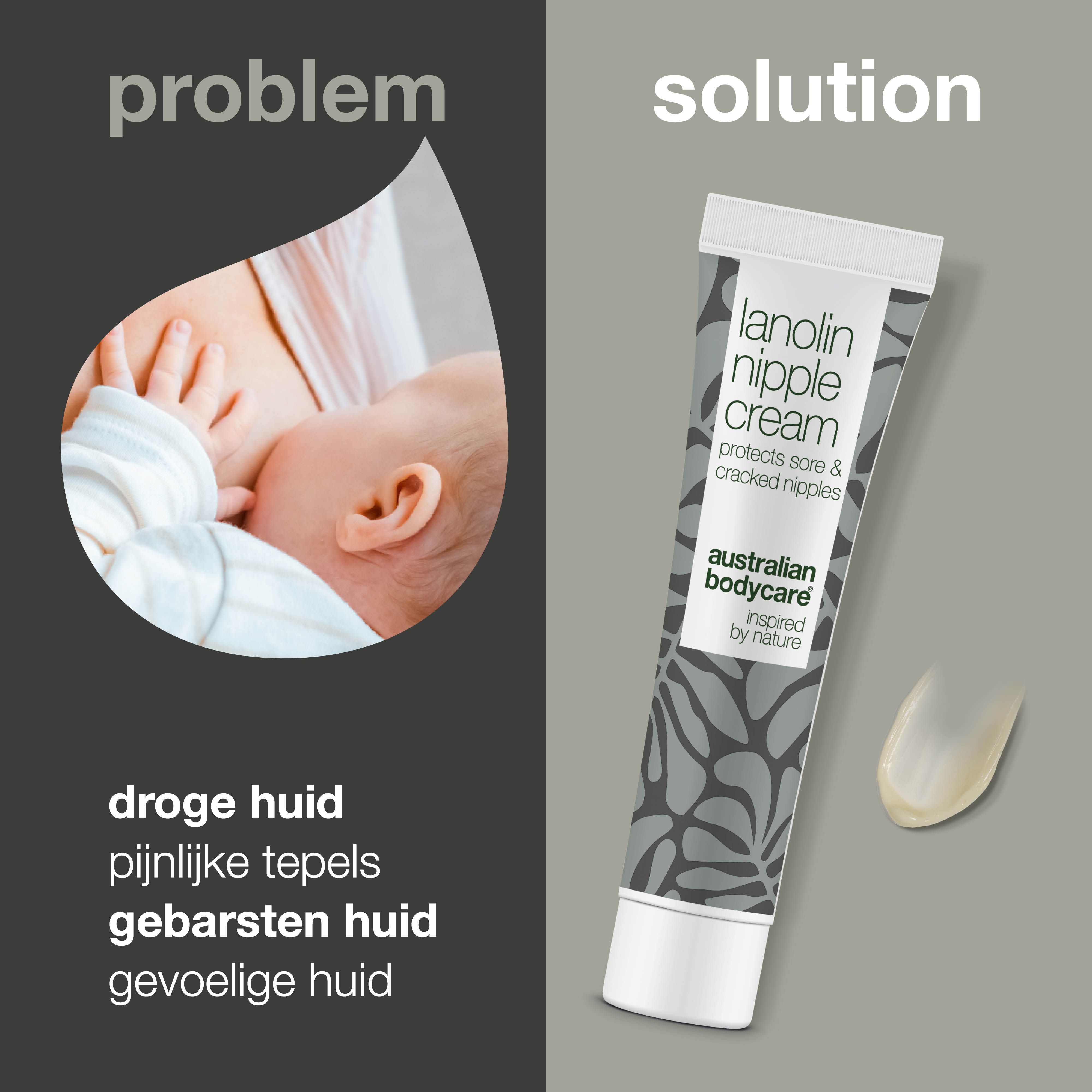 Probleem: droge, pijnlijke tepels. Oplossing: tube lanoline tepelcrème. Tekst: droge huid, pijnlijke tepels, gebarsten huid.