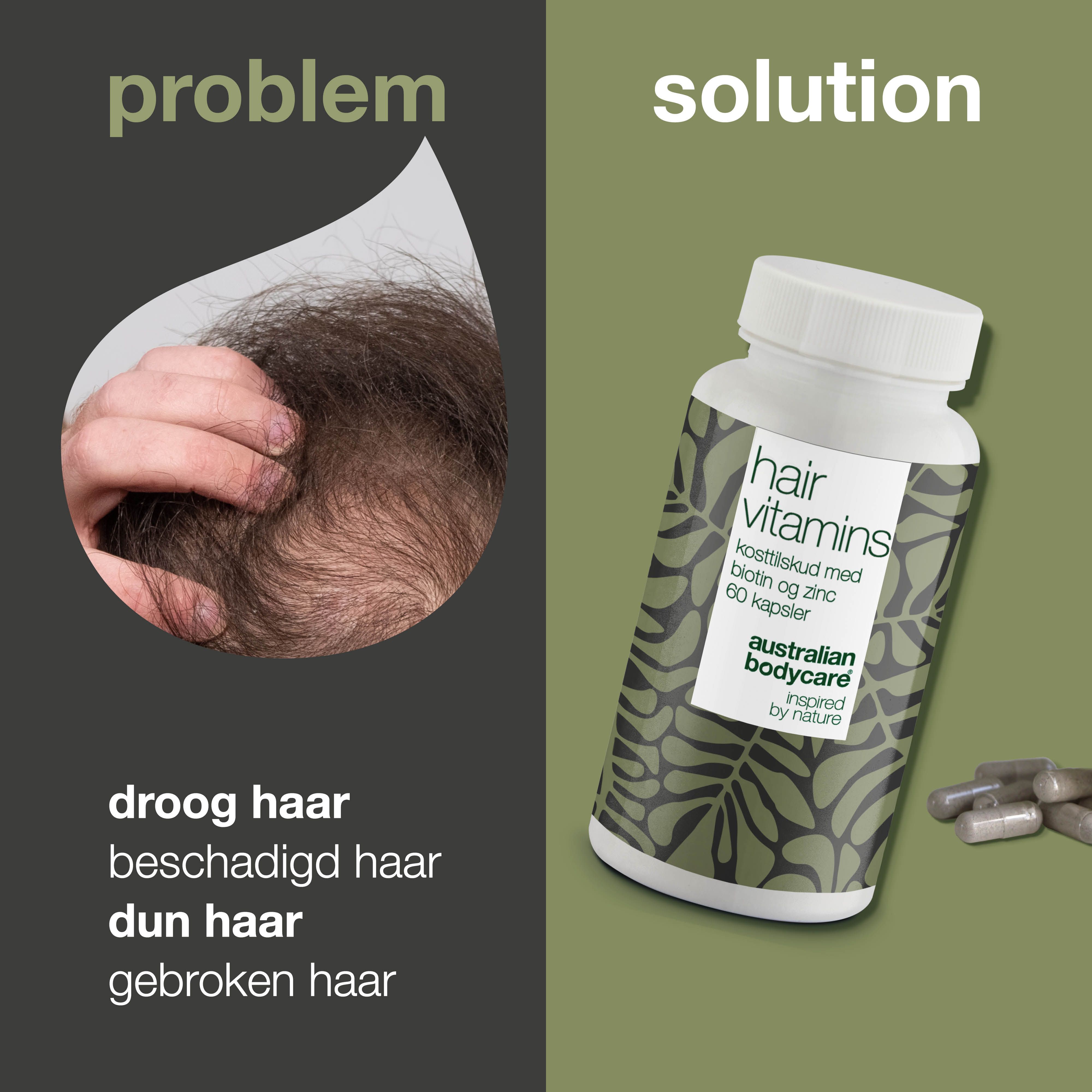 Haaroverzicht met tekst. Rechts: fles met capsules. Opschrift: Hair Vitamins, biotine en zink. Merk: Australian Bodycare.