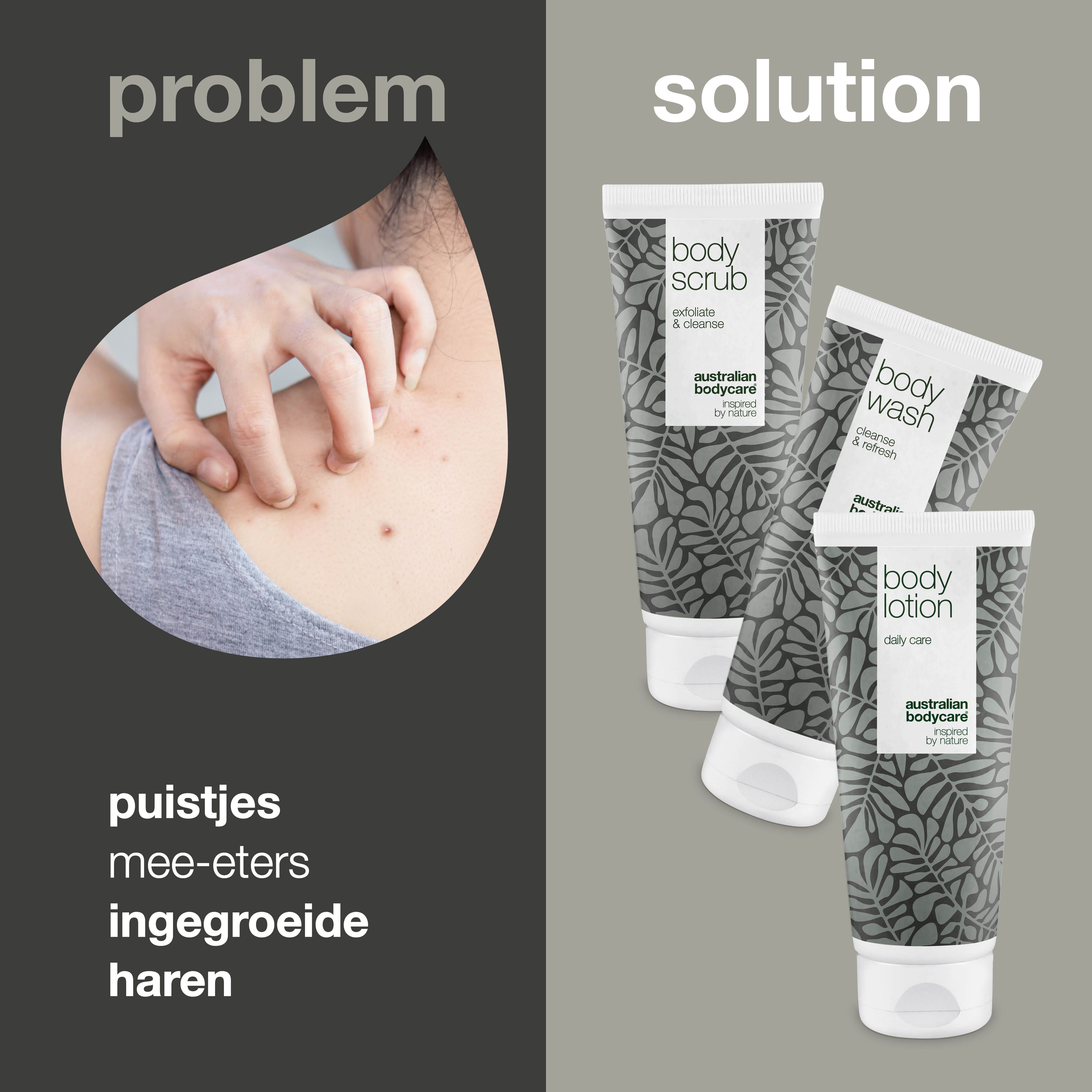 Probleem: puistjes, mee-eters, ingegroeide haren. Oplossing: drie tubes met lichaamsverzorgingsproducten.