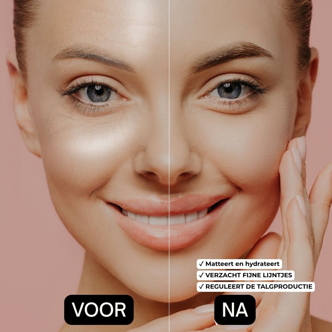 Voor-en-na-vergelijking. Gezicht van een vrouw. Tekst: Voor, Na, Matteert en hydrateert, Verzacht fijne lijntjes, Reguleert de talgproductie.