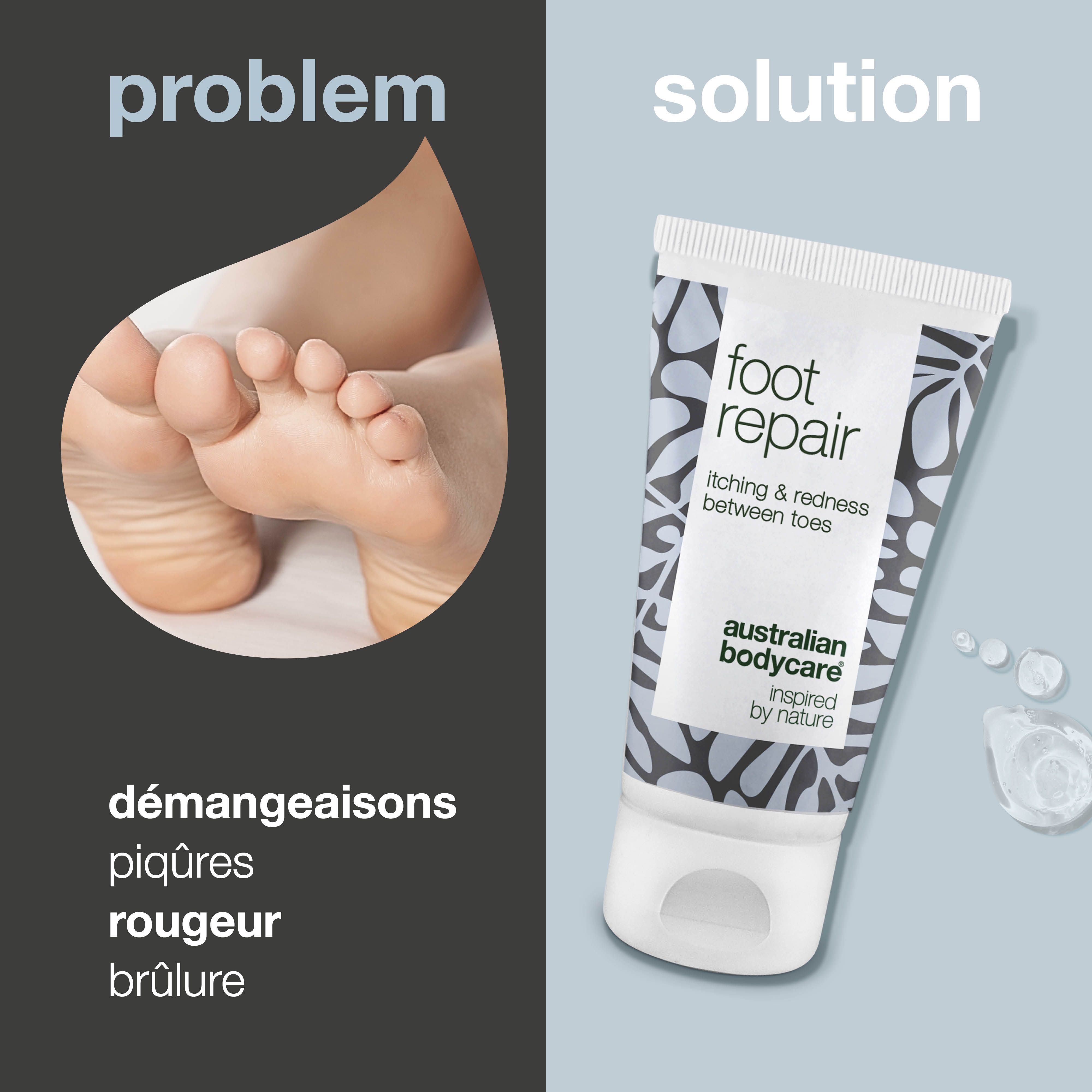 Pied avec démangeaisons, brûlures, rougeurs. Tube de soin des pieds : foot repair, itching & redness between toes, Australian Bodycare.