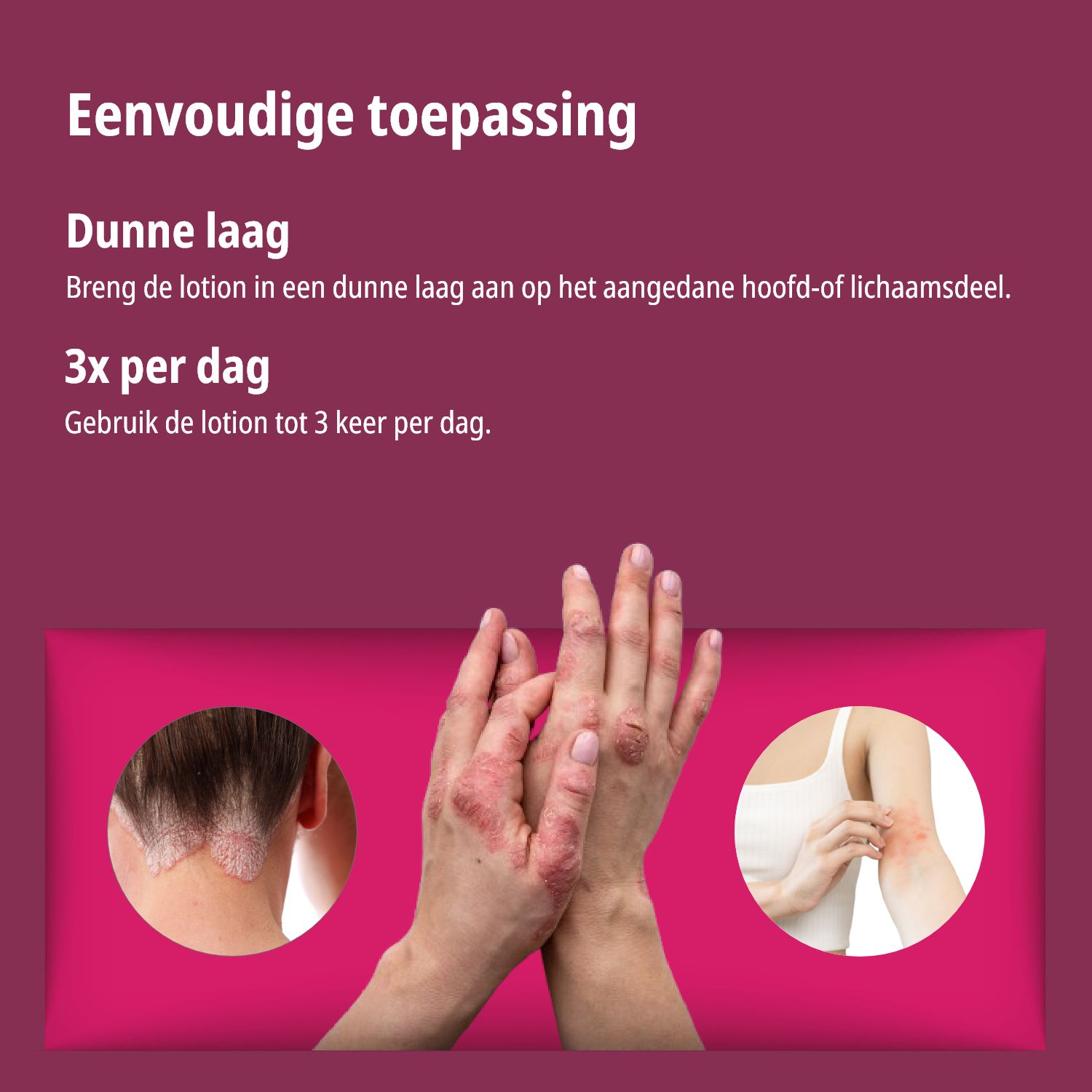 Grafiek: Toepassing van de lotion. Tekst: Dunne laag, 3x per dag. Getoond: Huid met eczeem. Lotion aanbrengen.