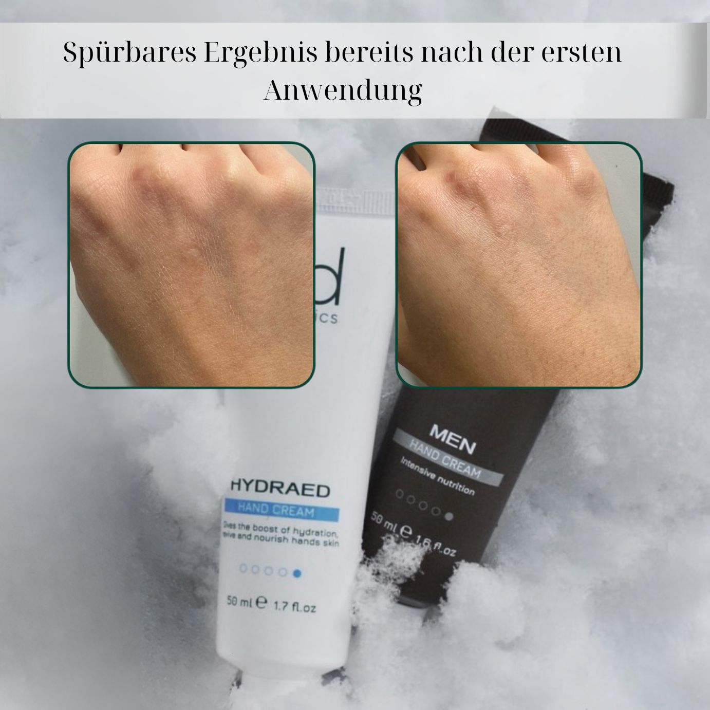 Comparaison des mains avant et après utilisation. Tube "ed cosmetics" et "HYDRAED HAND CREAM".