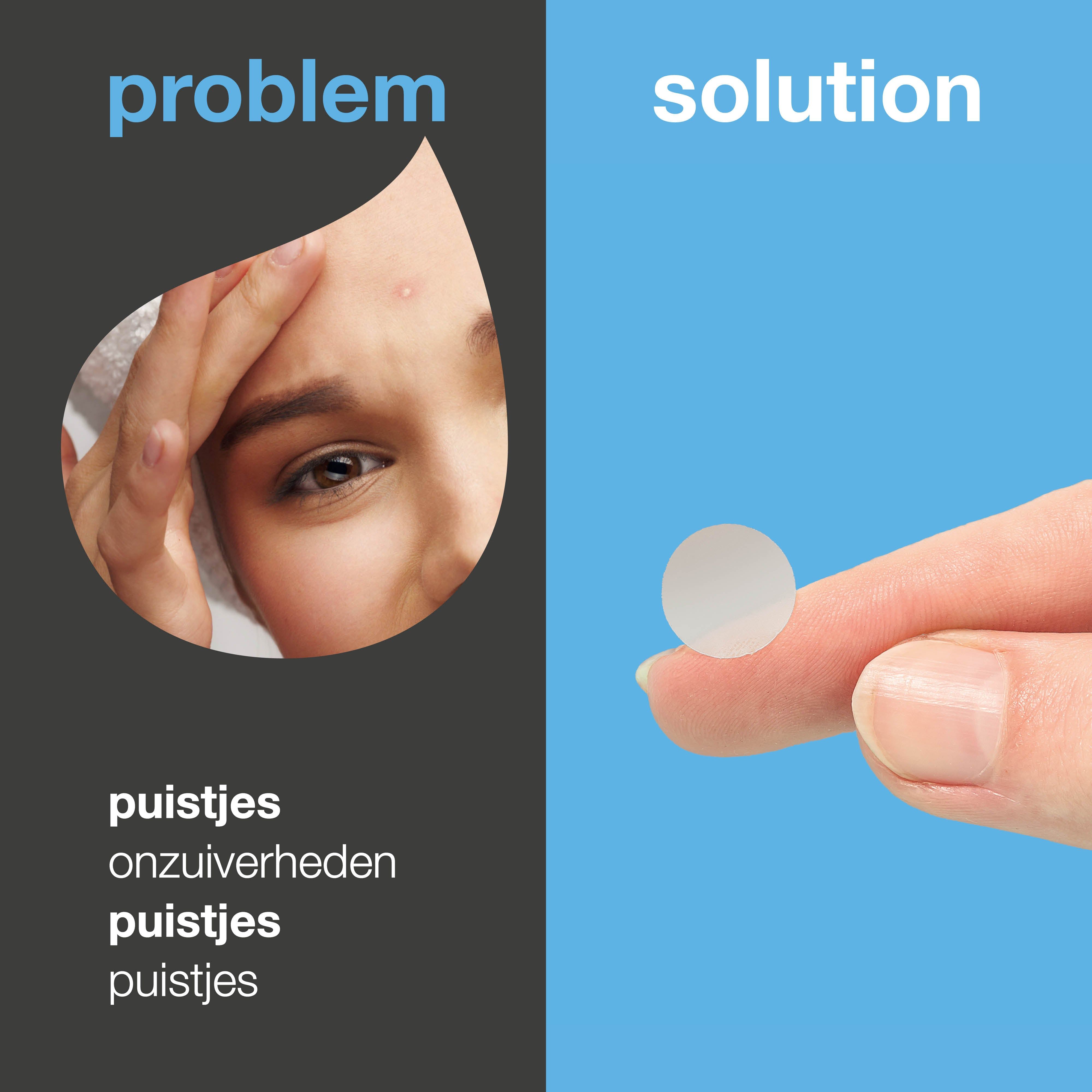 Gesplitste afbeelding: probleem en oplossing. Links: gezicht met puist. Rechts: pleister op een vinger.