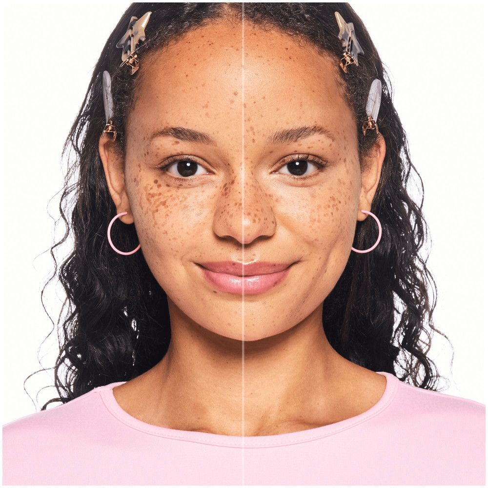 Gezicht van een vrouw, verdeeld in twee helften. Eén helft met onzuiverheden, de andere onberispelijk.