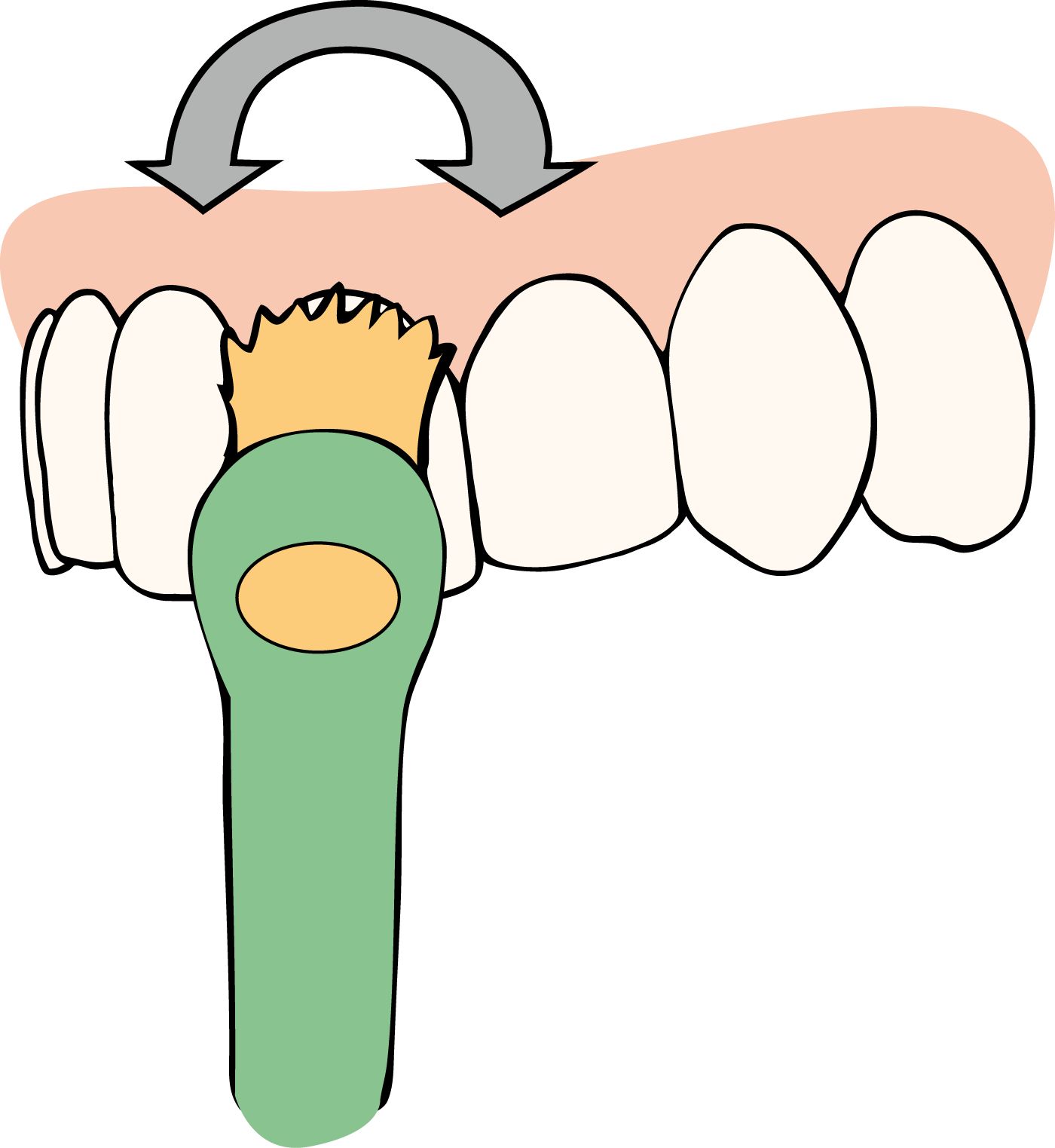 Illustration : brosse à dents nettoyant les dents. Les flèches indiquent le mouvement de brossage.