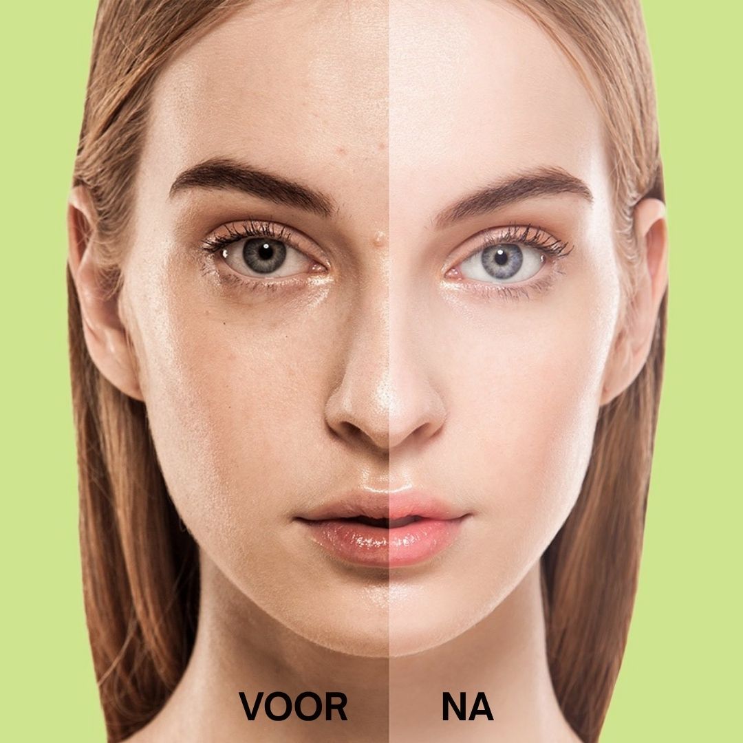 Gezicht van een vrouw, verdeeld in voor en na. Duidelijke verschillen in de huidtextuur.
