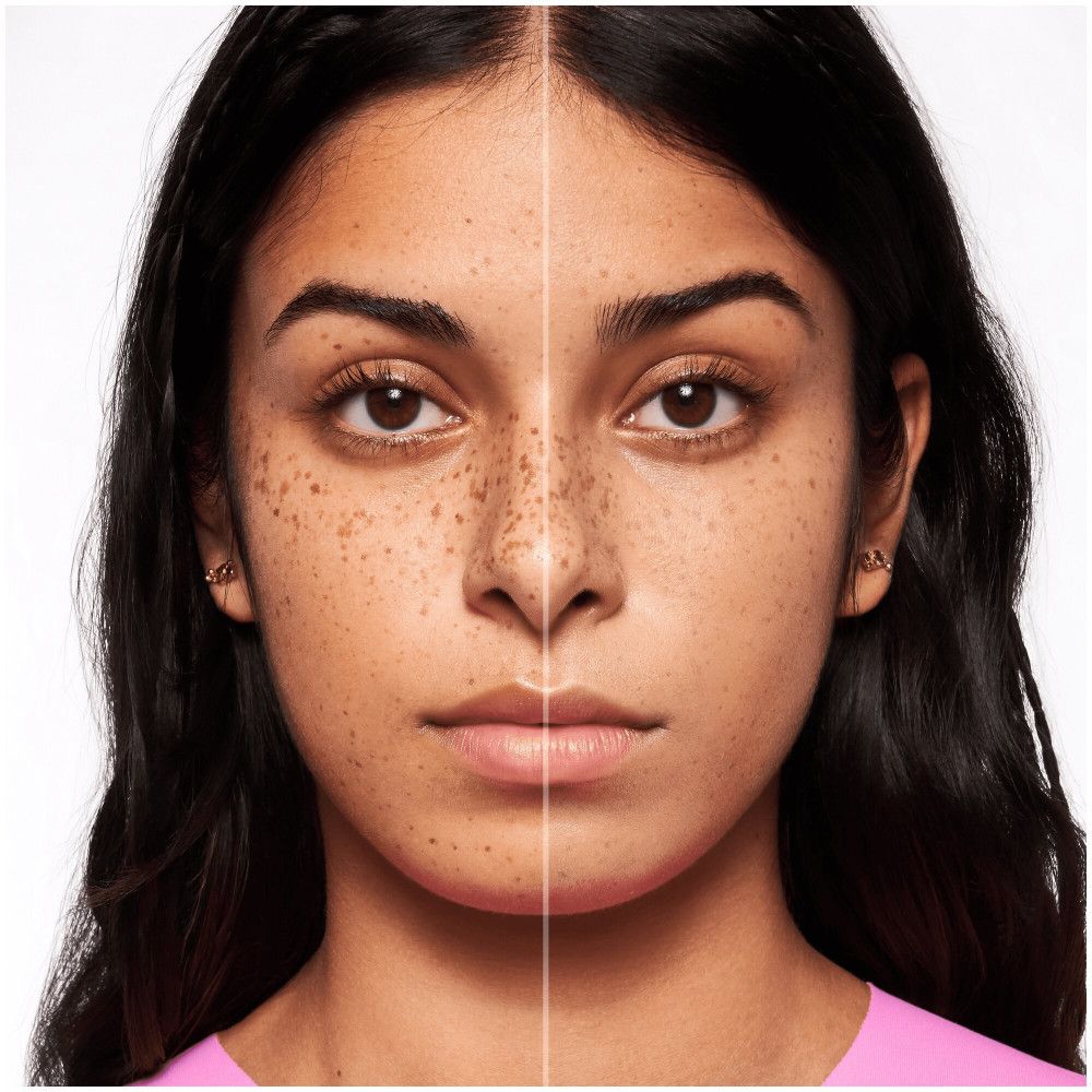 Visage divisé. Un côté avec imperfections, l'autre uniforme. Comparaison.