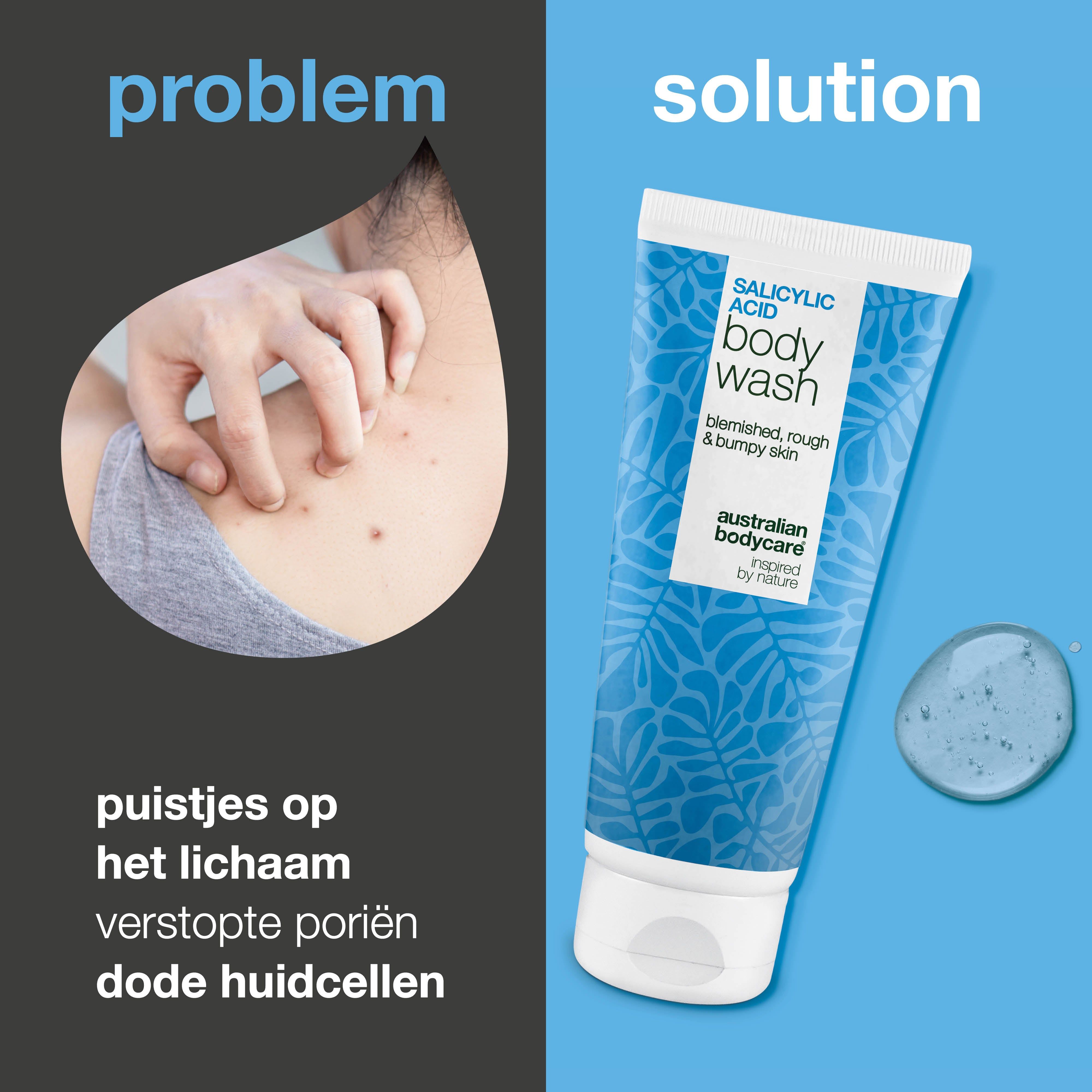 Vergelijking: probleem en oplossing. Persoon krabt. Tube body wash. Gel druppel. Tekst: puistjes, verstopte poriën.