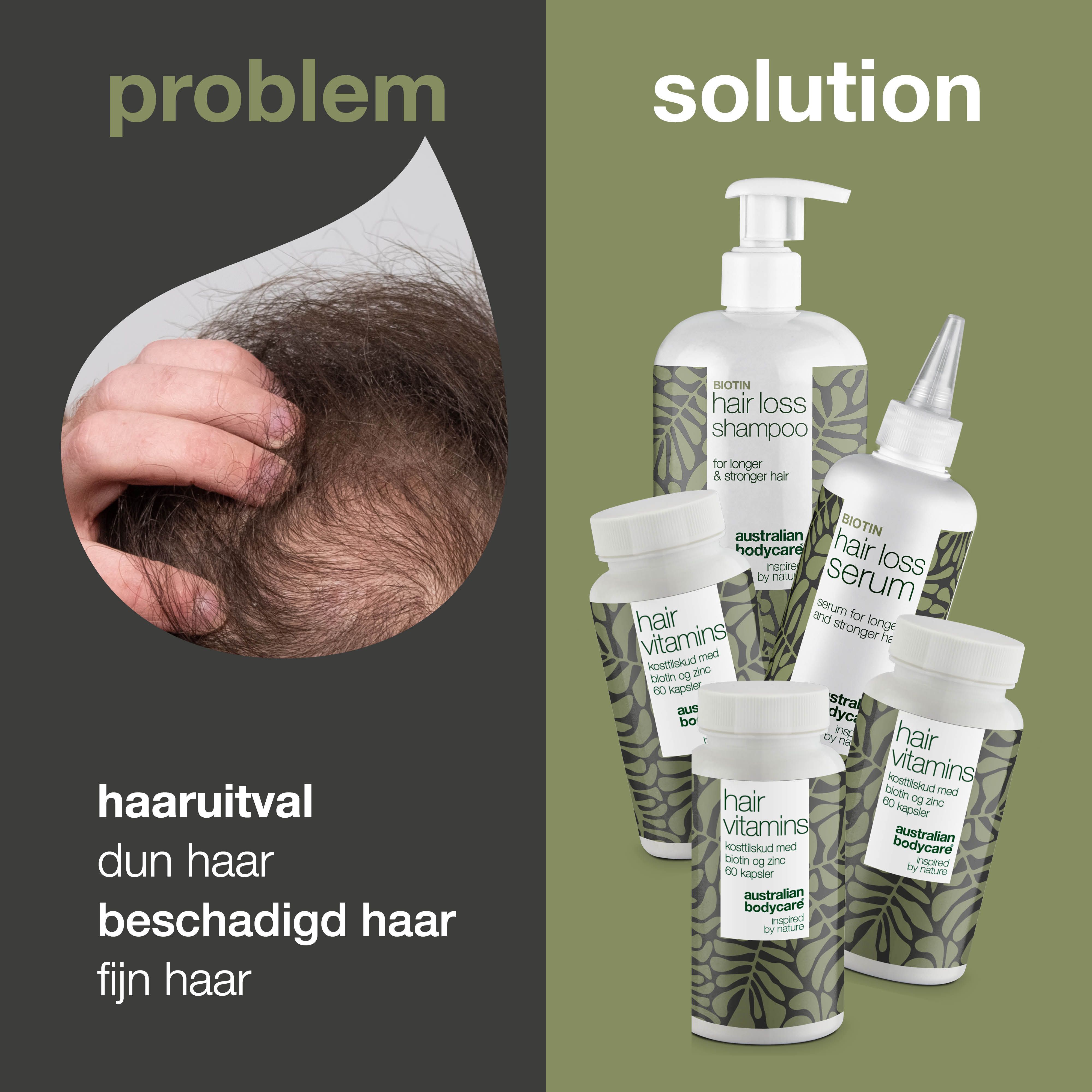 Haarlijn en producten. Opschrift: Hair Loss Shampoo, Hair Loss Serum, Hair Vitamins. Merk: Australian Bodycare.