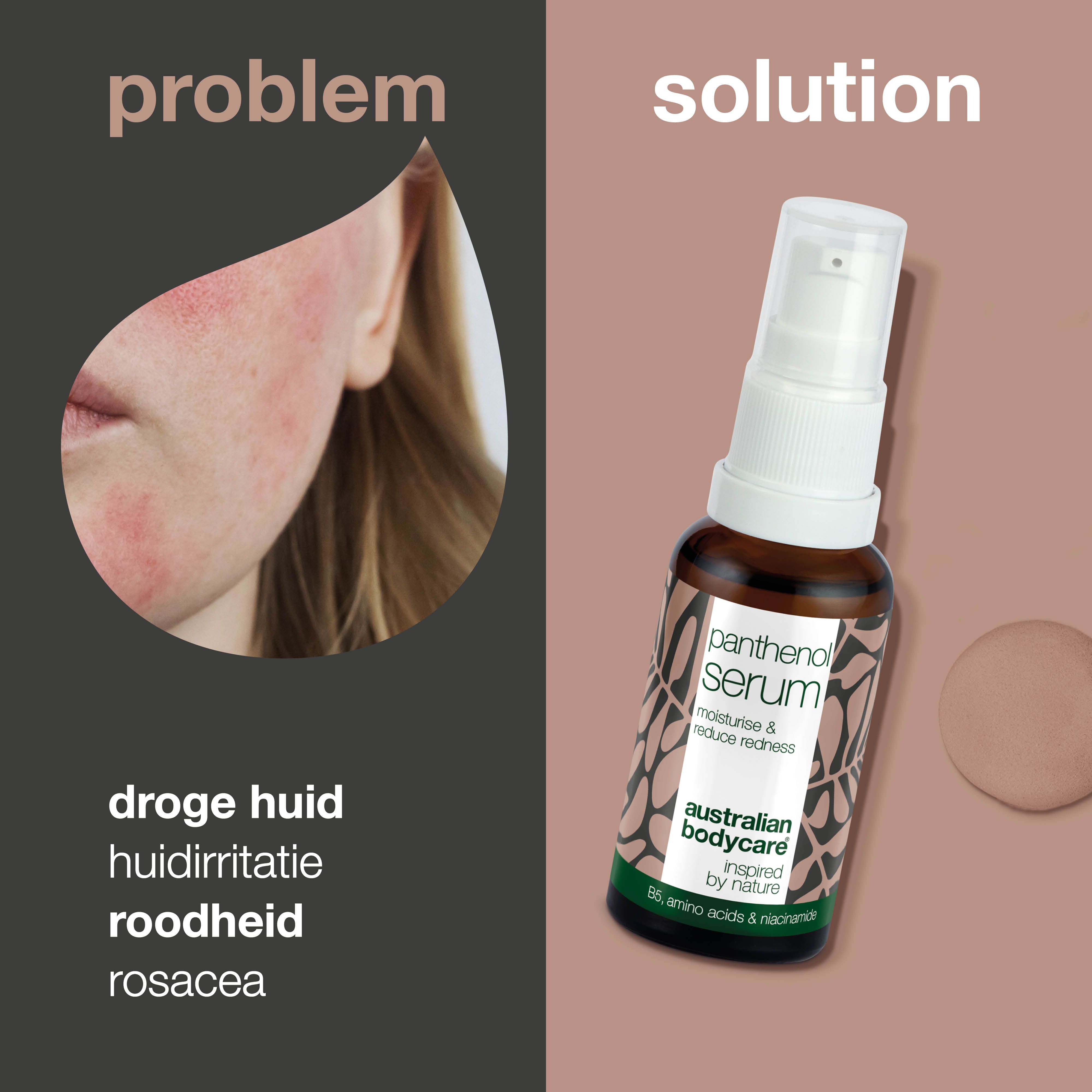 Gezicht met roodheid. Naast flesje Panthenol Serum. Tekst: droge huid, huidirritatie, roodheid.