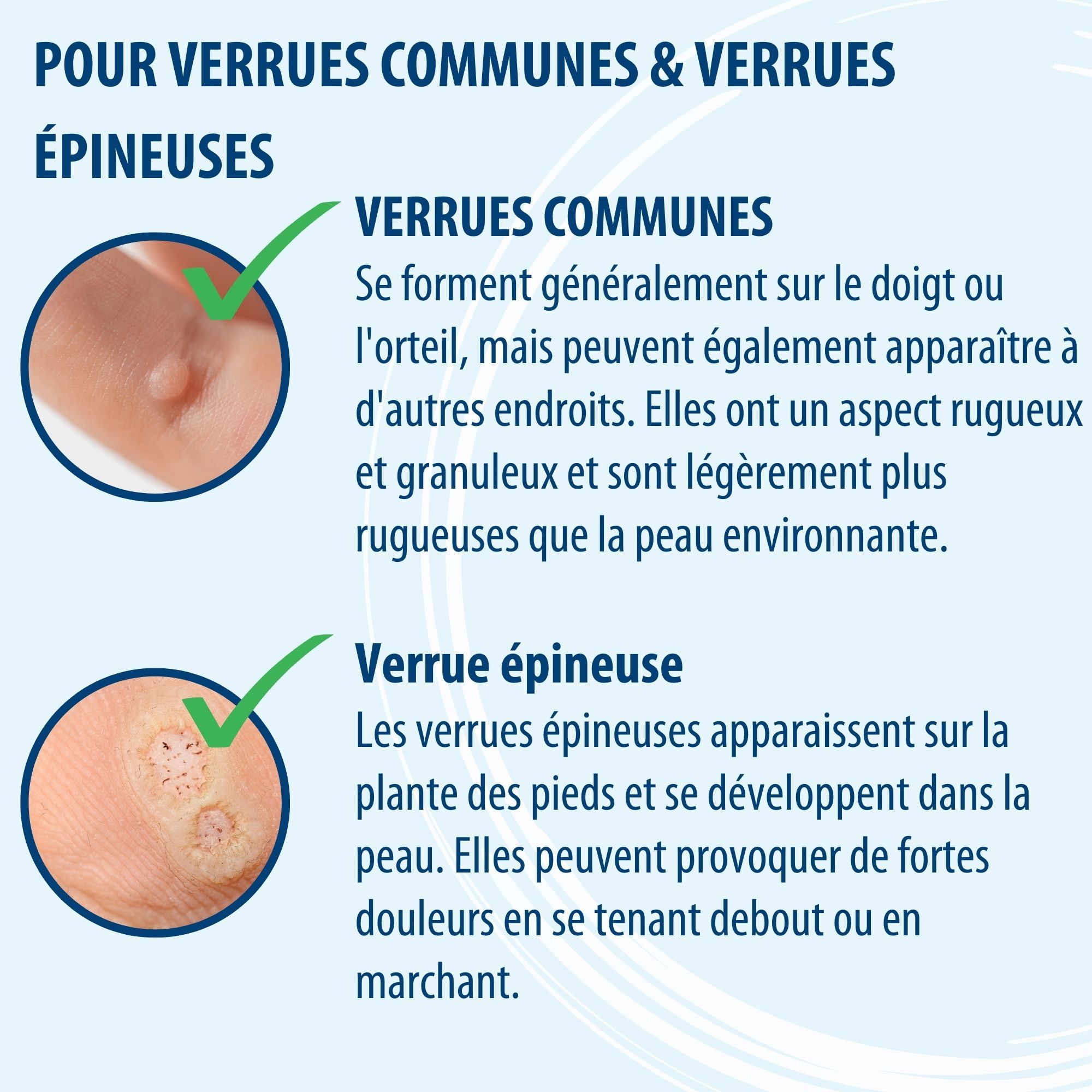 Infographie : Evolsin cryothérapie verrues. Efficace, stérile, hygiénique, facile à utiliser. Emballage.