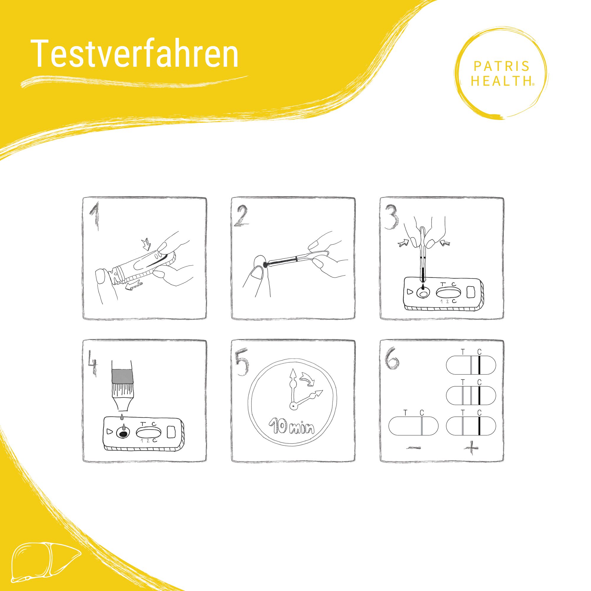 Gele achtergrond. Patris Health logo. Testprocedure in 6 stappen: afname, aanbrengen, resultaat. Illustraties.