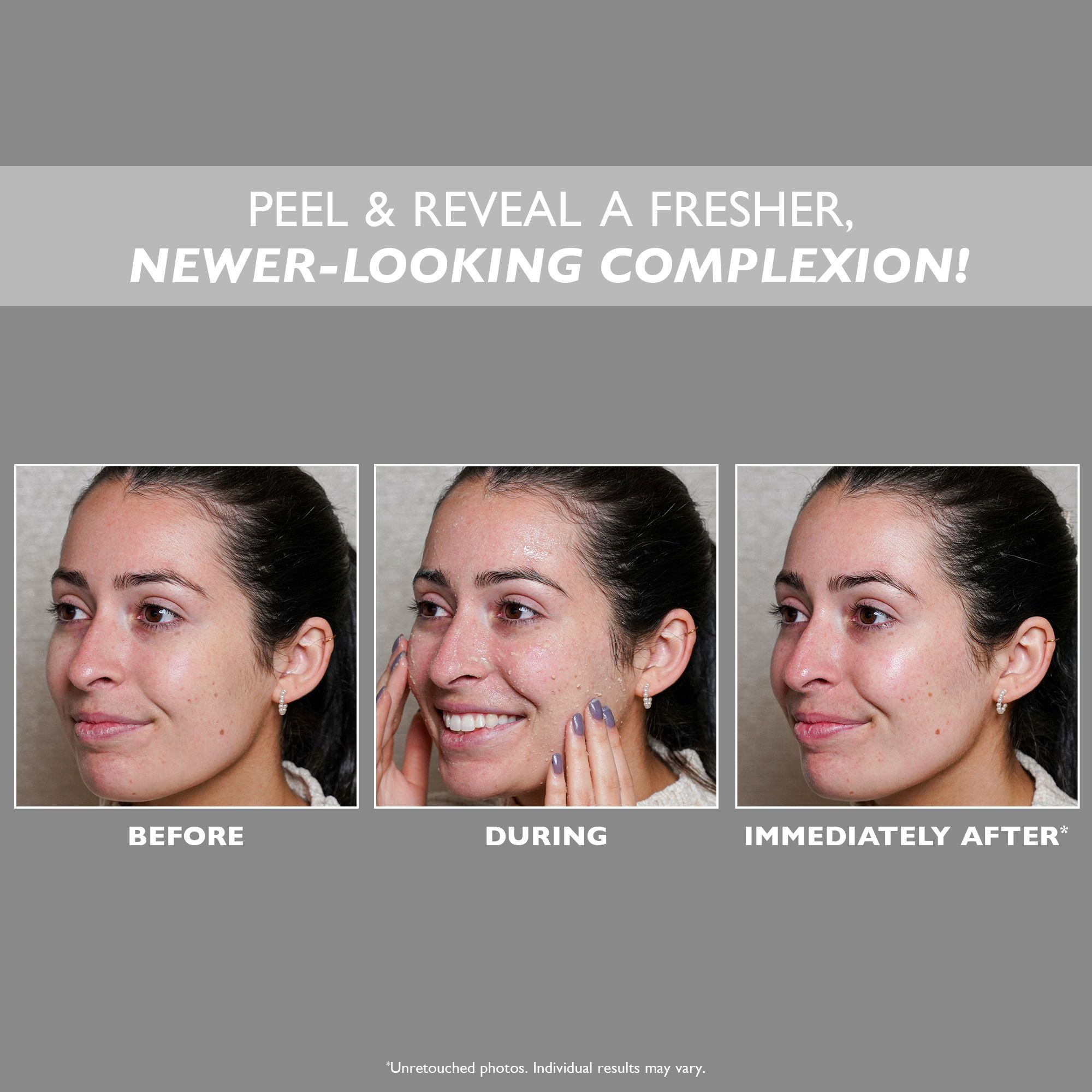 Drie foto's: Voor, Tijdens, Direct daarna. Tekst: PEEL & REVEAL A FRISHER, NEWER-LOOKING COMPLEXION! Vrouw met onzuiverheden, gezichtsuitdrukking verandert.