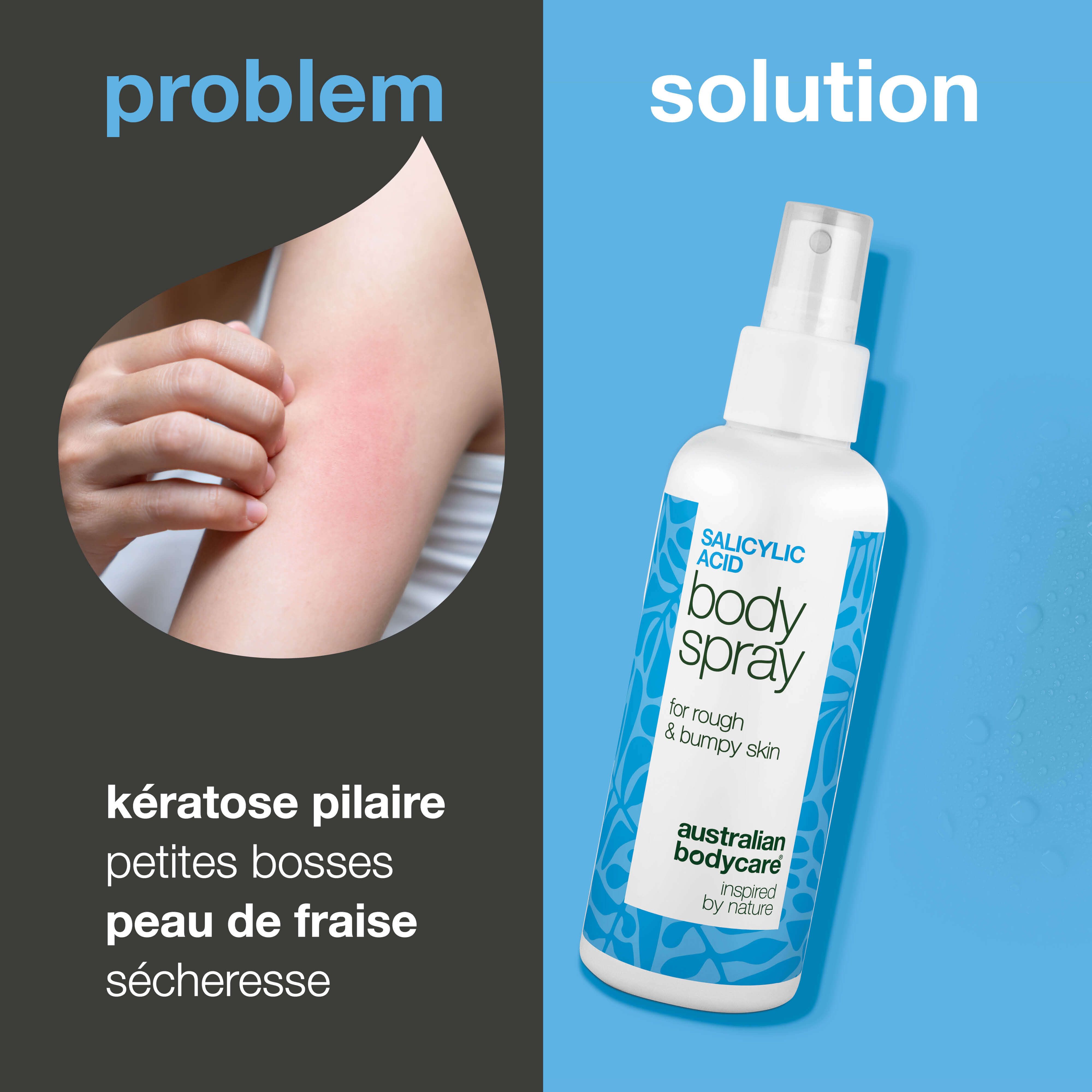 Produit à côté d'un bras avec rougeurs cutanées. Texte : kératose pilaire, petites bosses, peau de fraise, sécheresse. Produit : Body Spray.