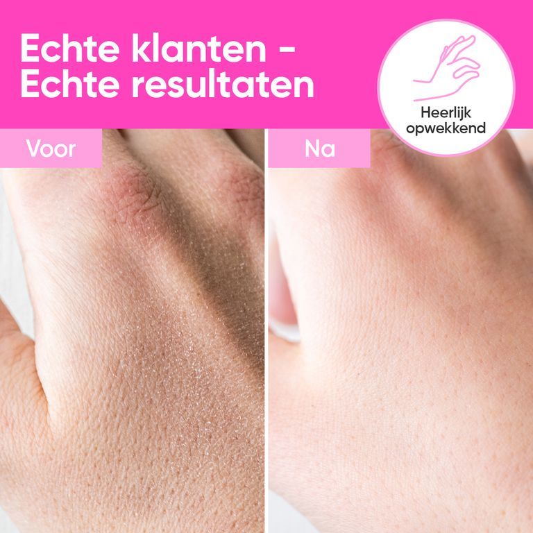 Voor-en-na vergelijking van handen behandeld met handcrème. Tekst in het Nederlands.
