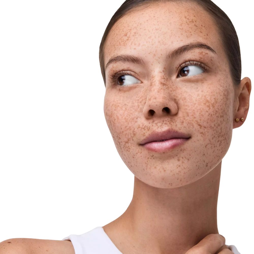 Portrait d'une femme avec des taches de rousseur, regardant sur le côté. Fond blanc.
