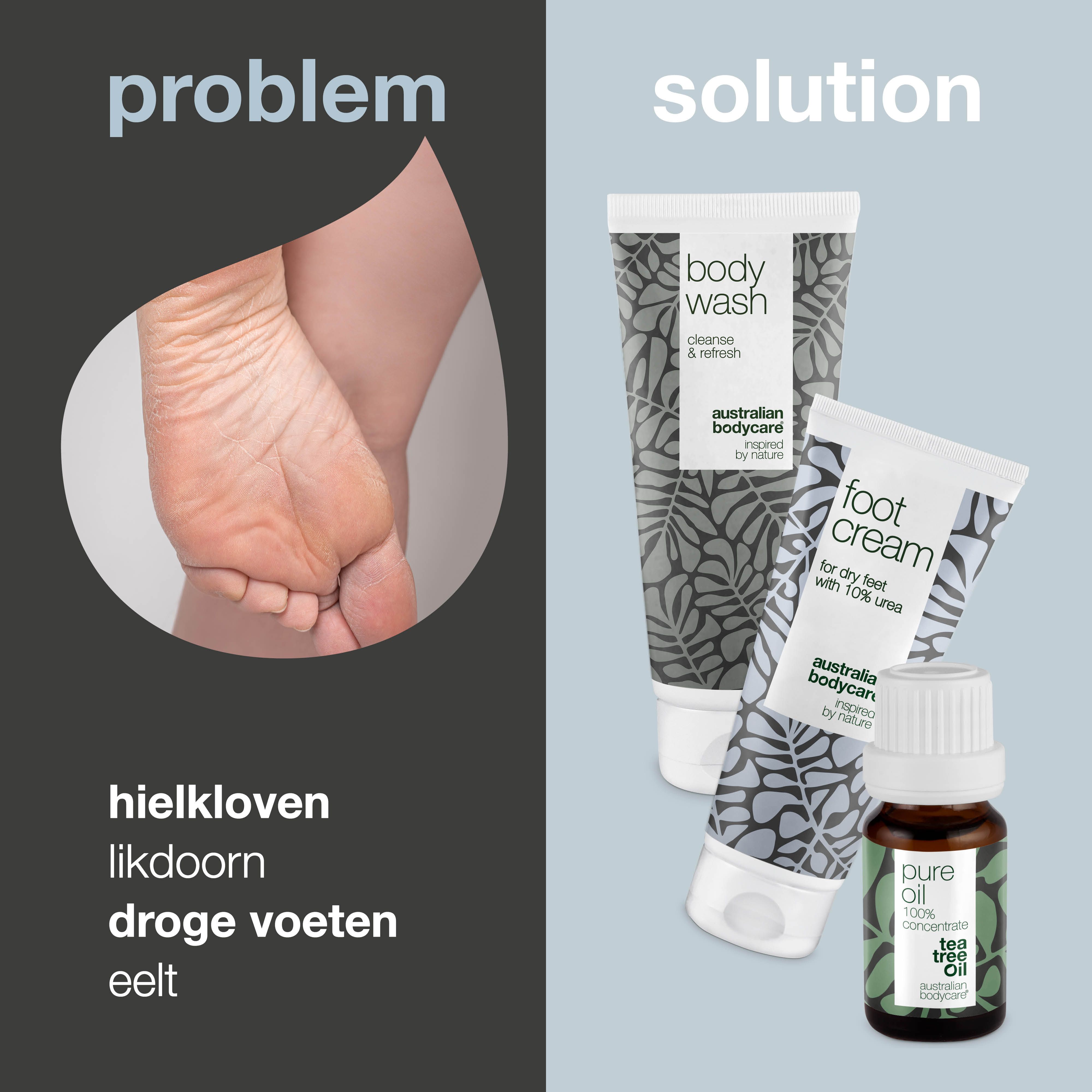 Vergelijking probleem en oplossing. Gebarsten hiel naast producten: body wash, voetcrème, tea tree olie.