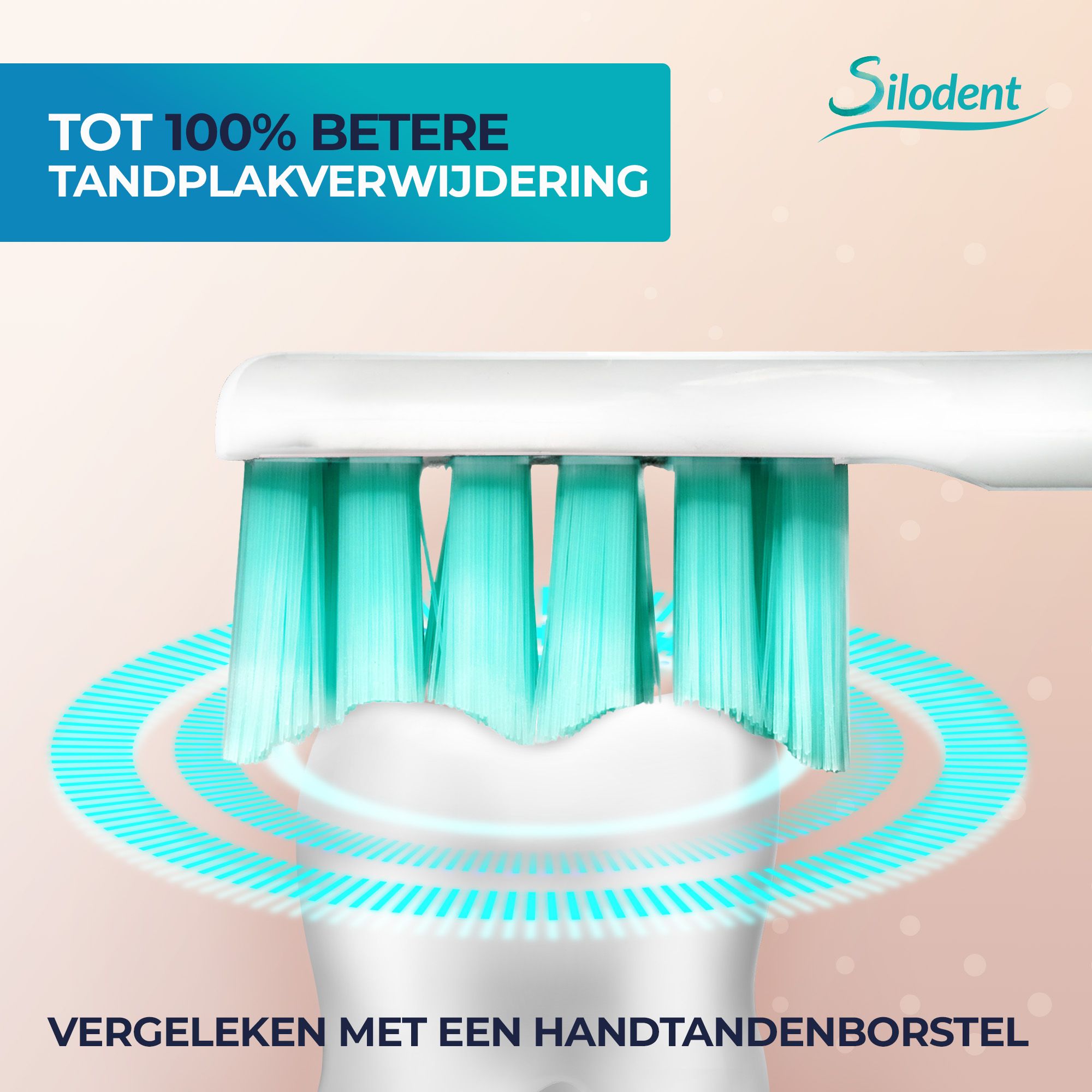 Close-up van de borstelkop van een Silodent sonische tandenborstel met antibacteriële borstelharen.