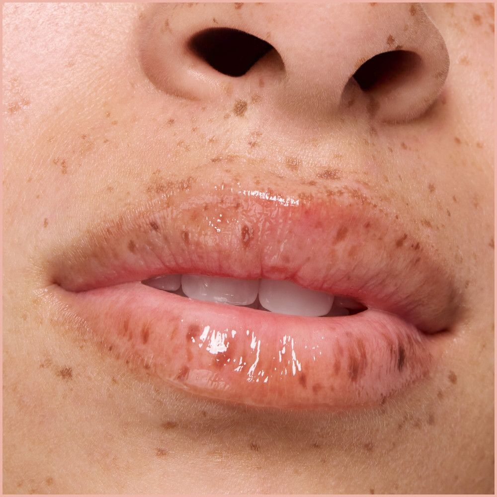 Gros plan sur des lèvres avec baume brillant. Peau avec des taches de rousseur.