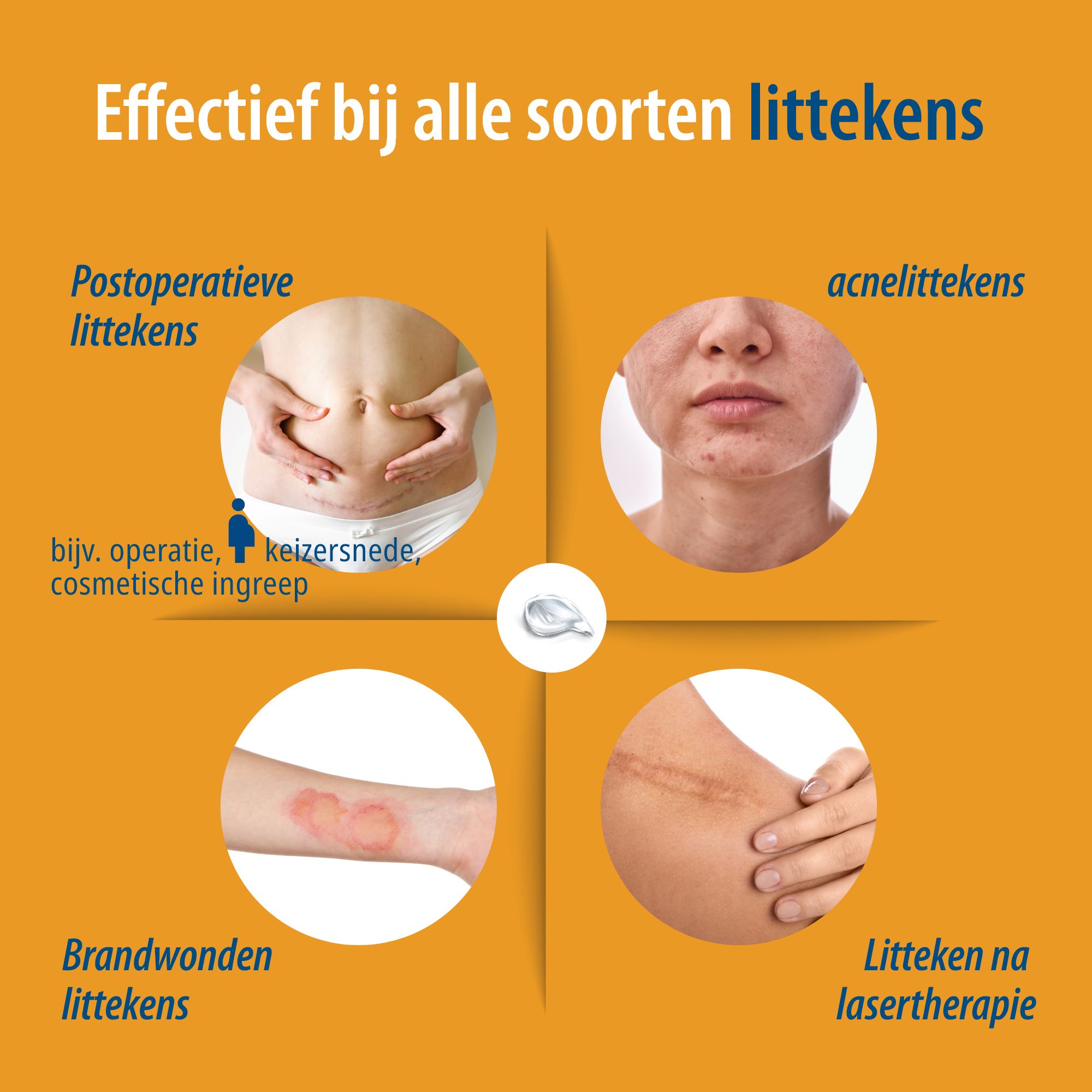 Productafbeelding: Evolsin Narbengel, tube en doos, met logo en productnaam.