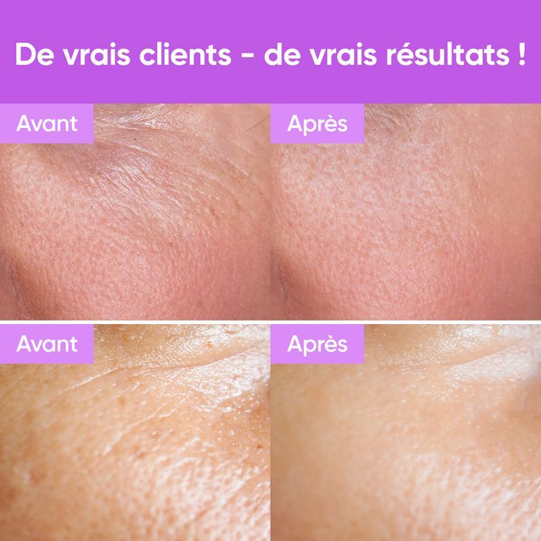 Une femme tient un flacon de sérum Youth Concentrate, avec texte sur la teneur en actifs.