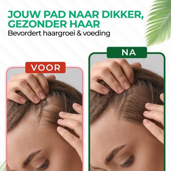 Nouelv Batana Oil - 100% Puur & Natuurlijke Haarolie tegen Haaruitval - Dermatologisch Getest