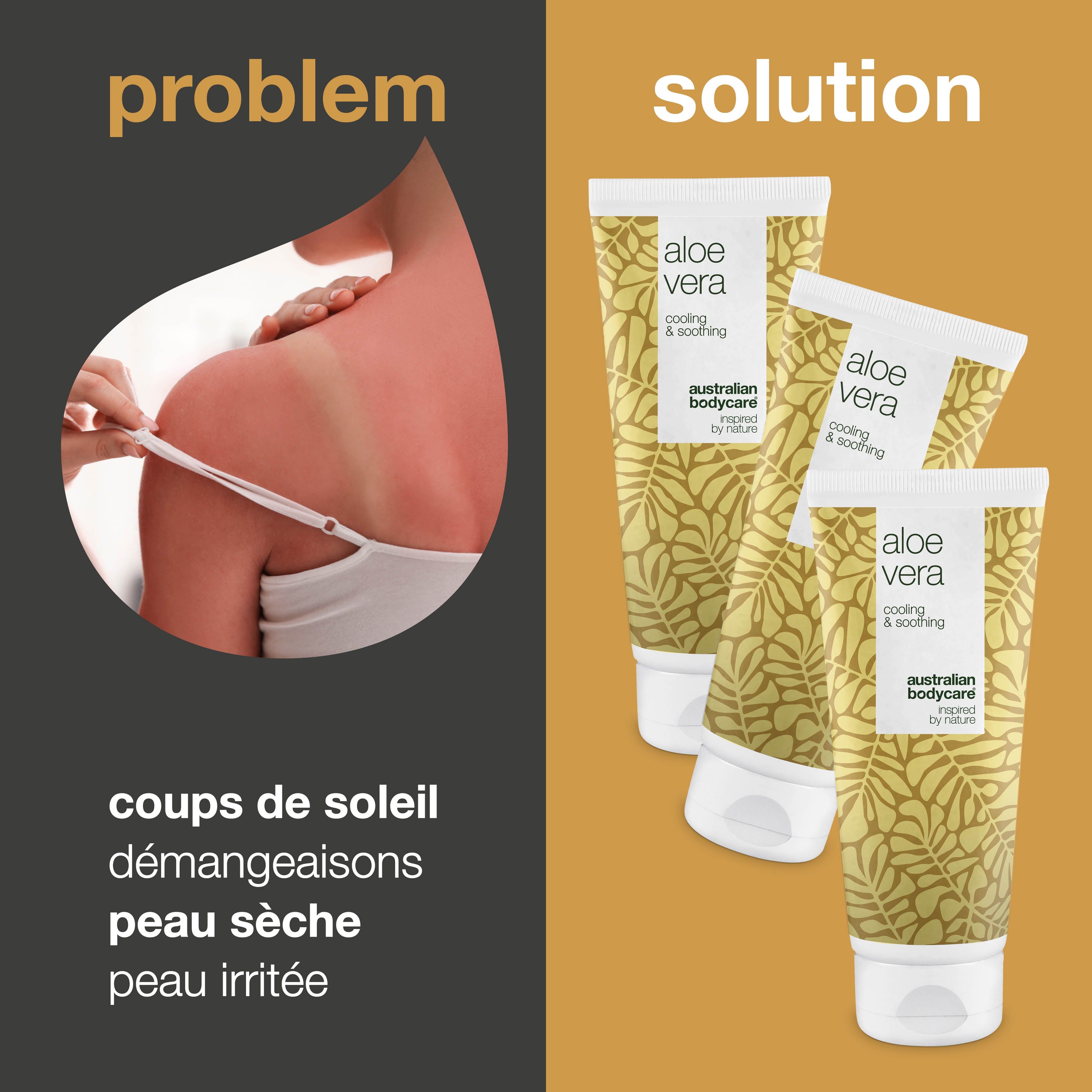 Comparaison : coups de soleil, démangeaisons, peau sèche, irritée. Solution : gel Aloe Vera. Australian Bodycare.