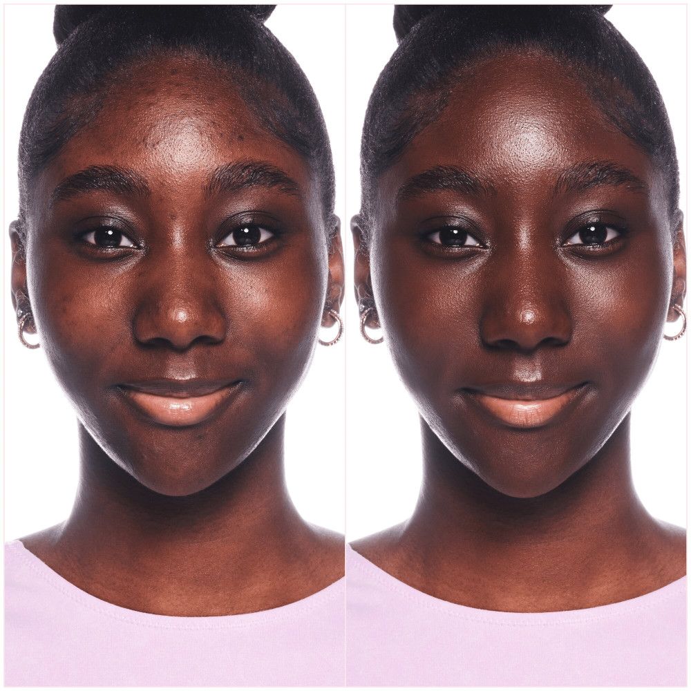 Comparaison avant-après. Visage d'une personne avant et après l'application du fond de teint.