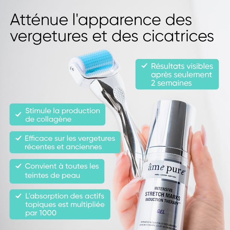 Main tenant un rouleau et une bouteille de gel pour le traitement des vergetures.