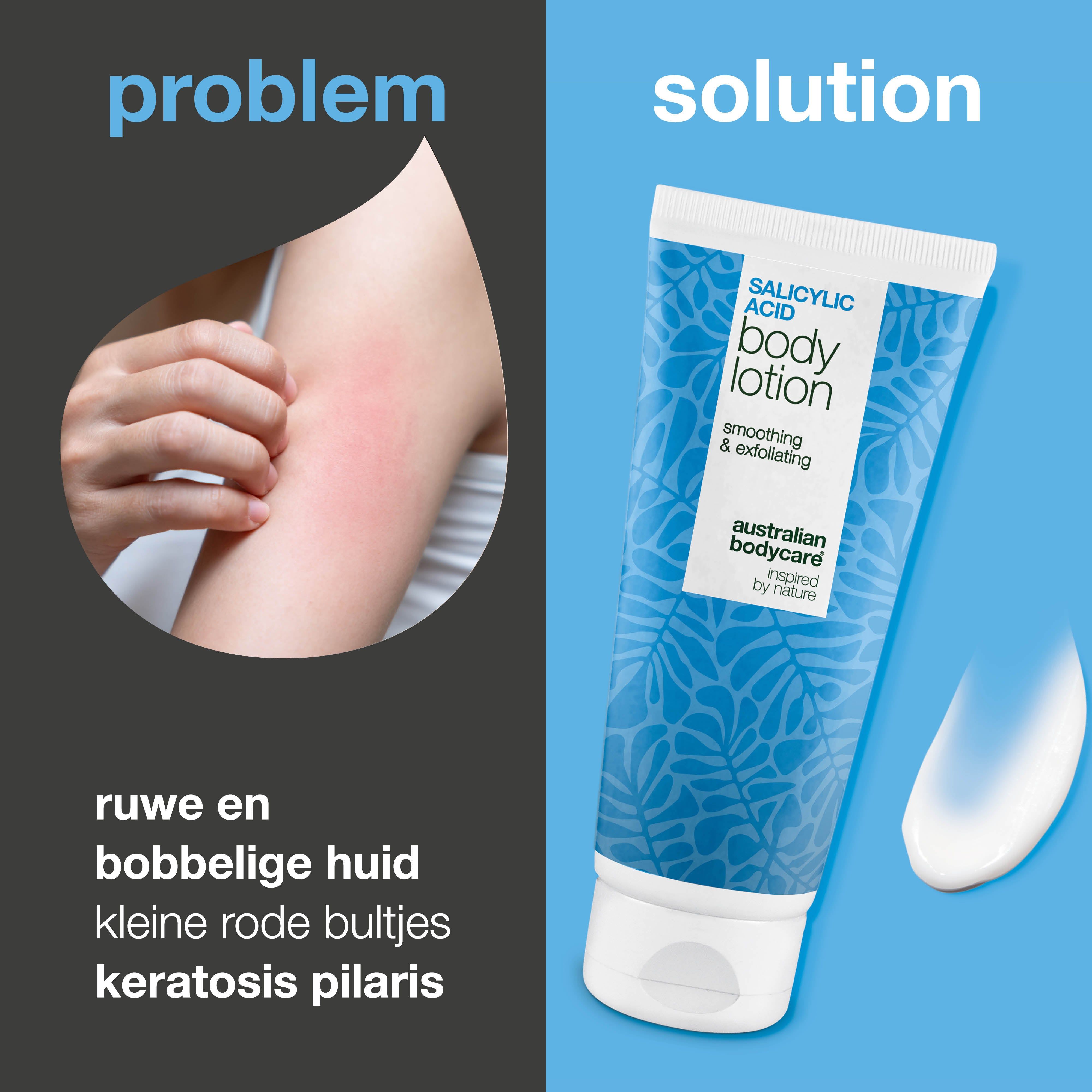 Probleem/oplossing afbeelding. Arm met huiduitslag. Salicylzuur Body Lotion. Tekst: Australian Bodycare. Ruwe huid, kleine rode bultjes.