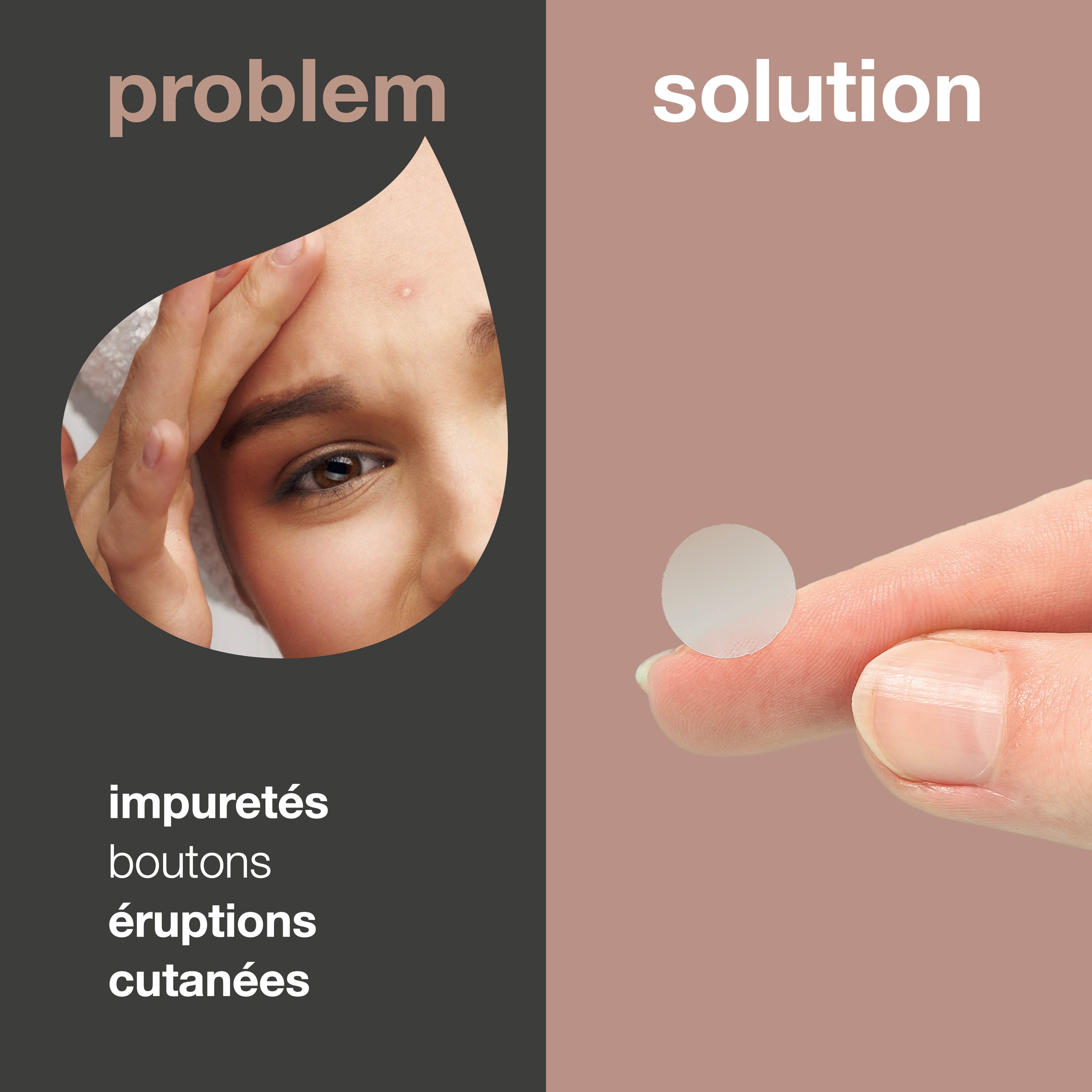 Image en deux parties. Gauche : visage avec bouton. Droite : patch anti-boutons sur le doigt. Texte : Problème, Solution.