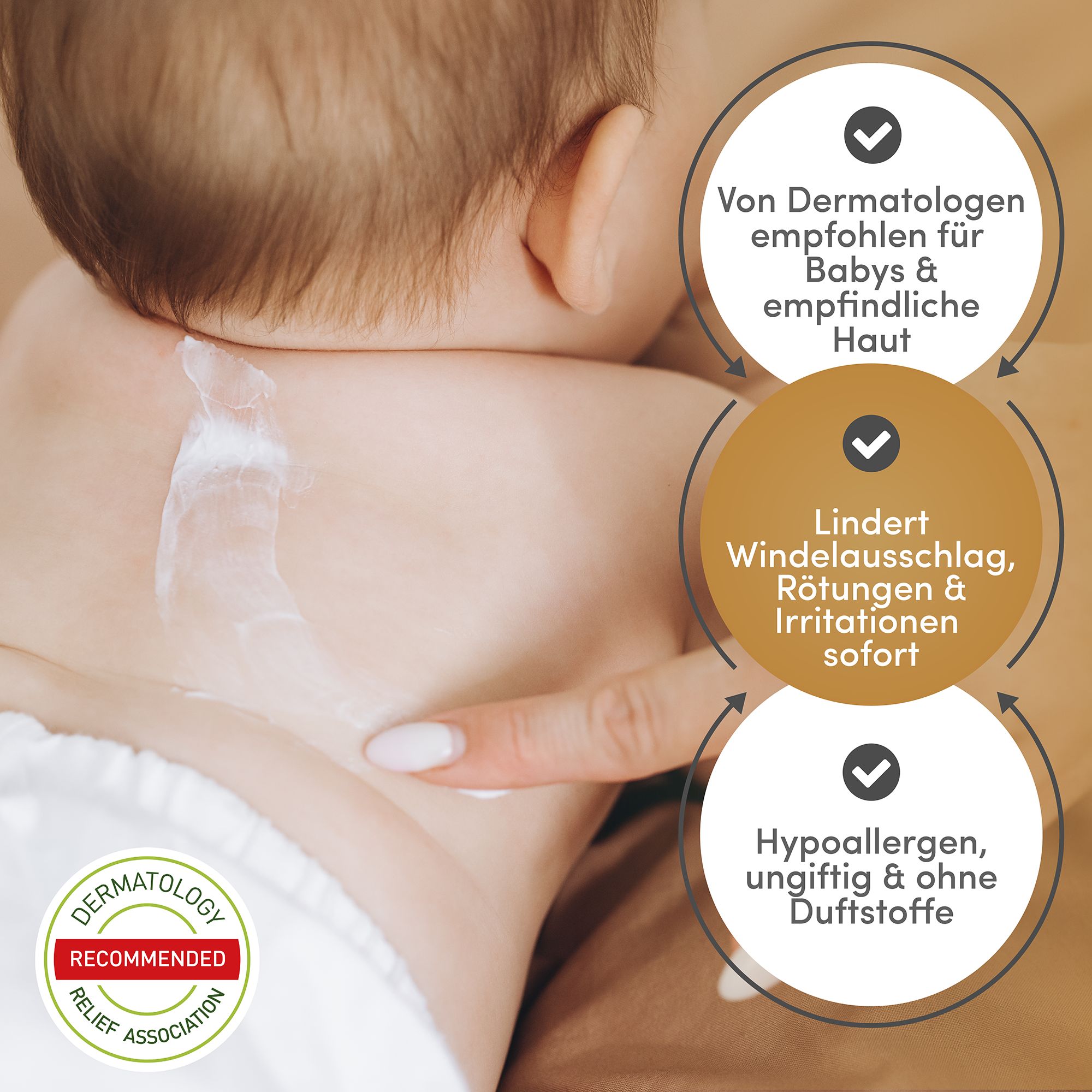 Bébé avec crème sur le cou. Texte: Recommandé par les dermatologues, Soulage l'érythème fessier, Hypoallergénique, sans parfum.