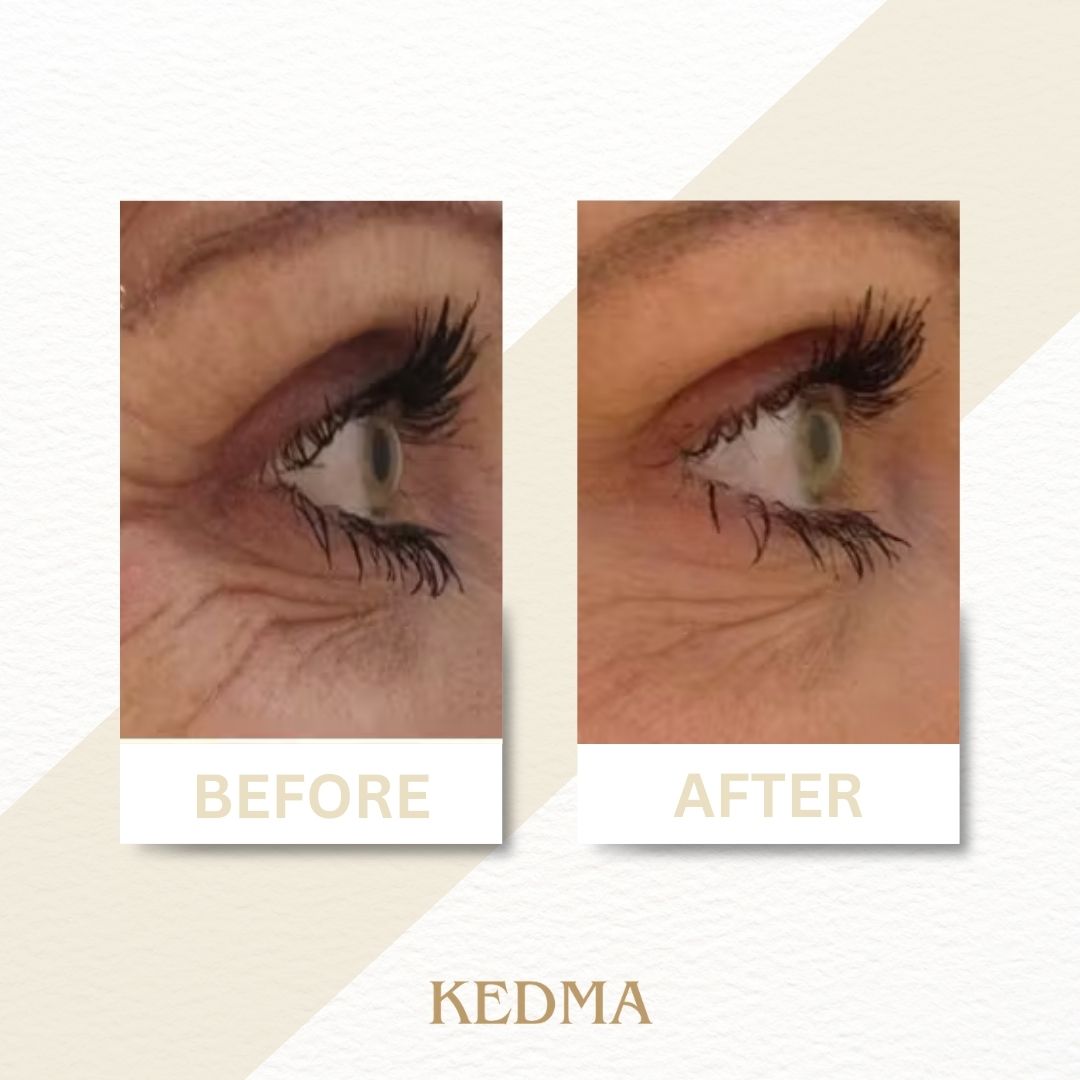Kedma - Anti-Aging Oogcrème met Collageen en Mineralen uit de Dode Zee
