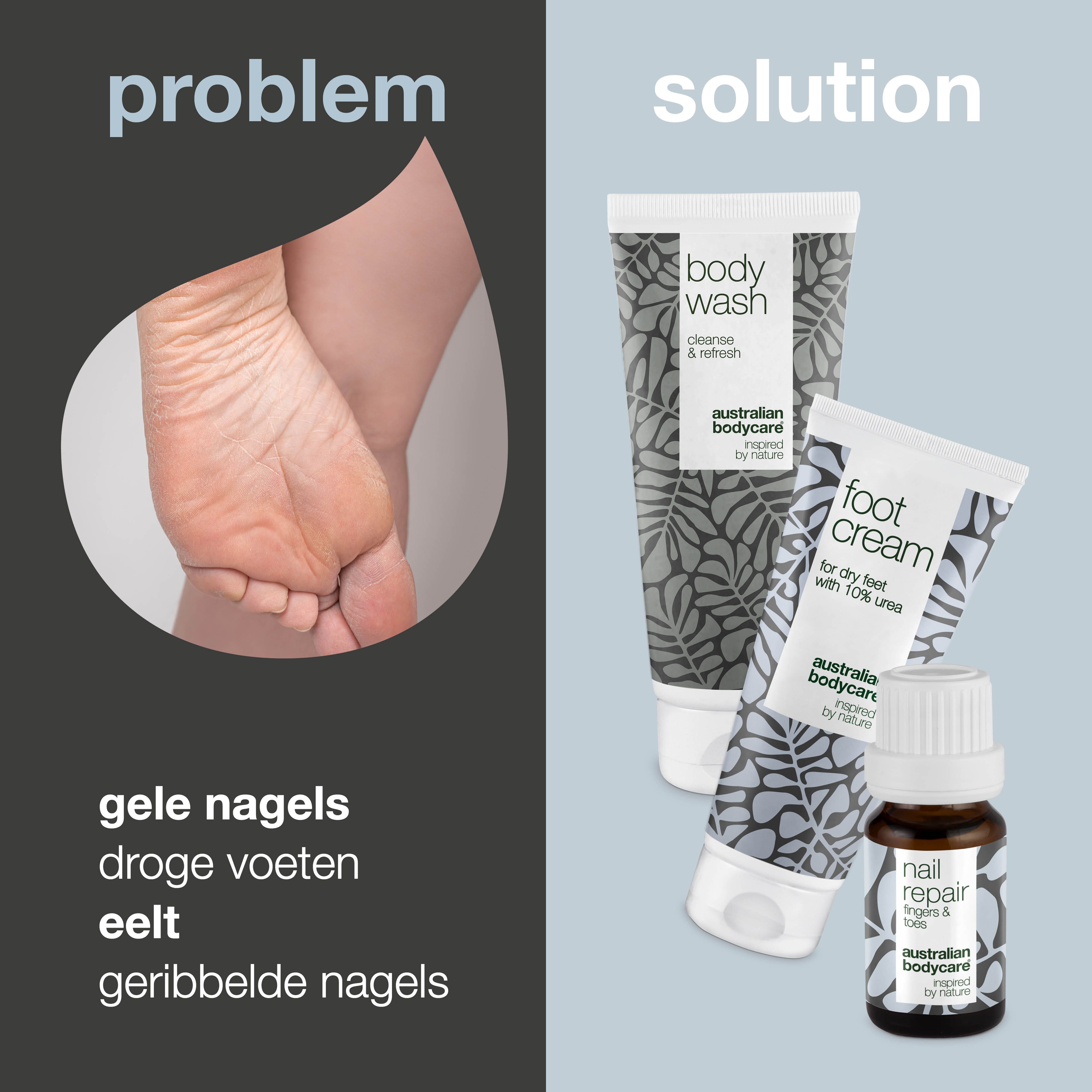 Probleem: gele nagels, droge voeten, eelt, gescheurde nagels. Oplossing: producten van Australian Bodycare.