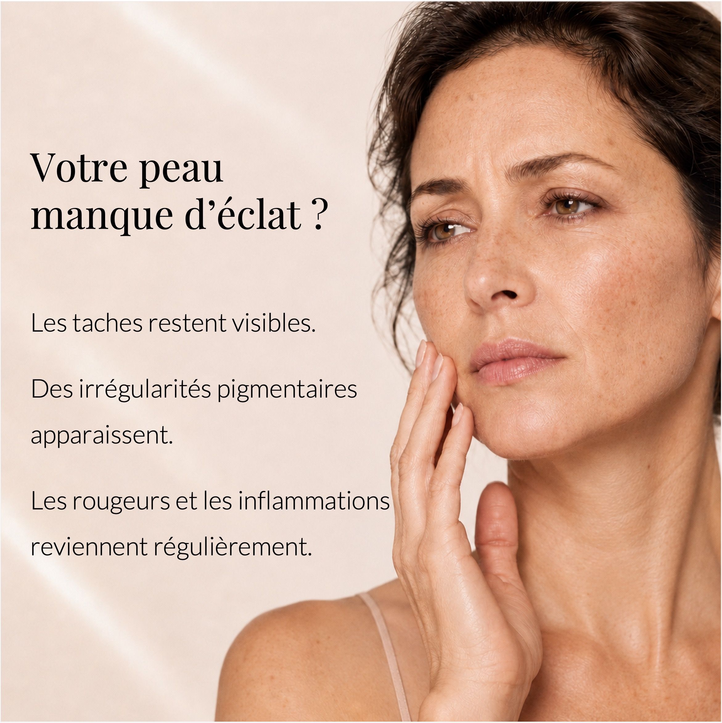 Femme avec peau impure, main touchant la joue. Texte : 'Votre peau manque d'éclat ?'.