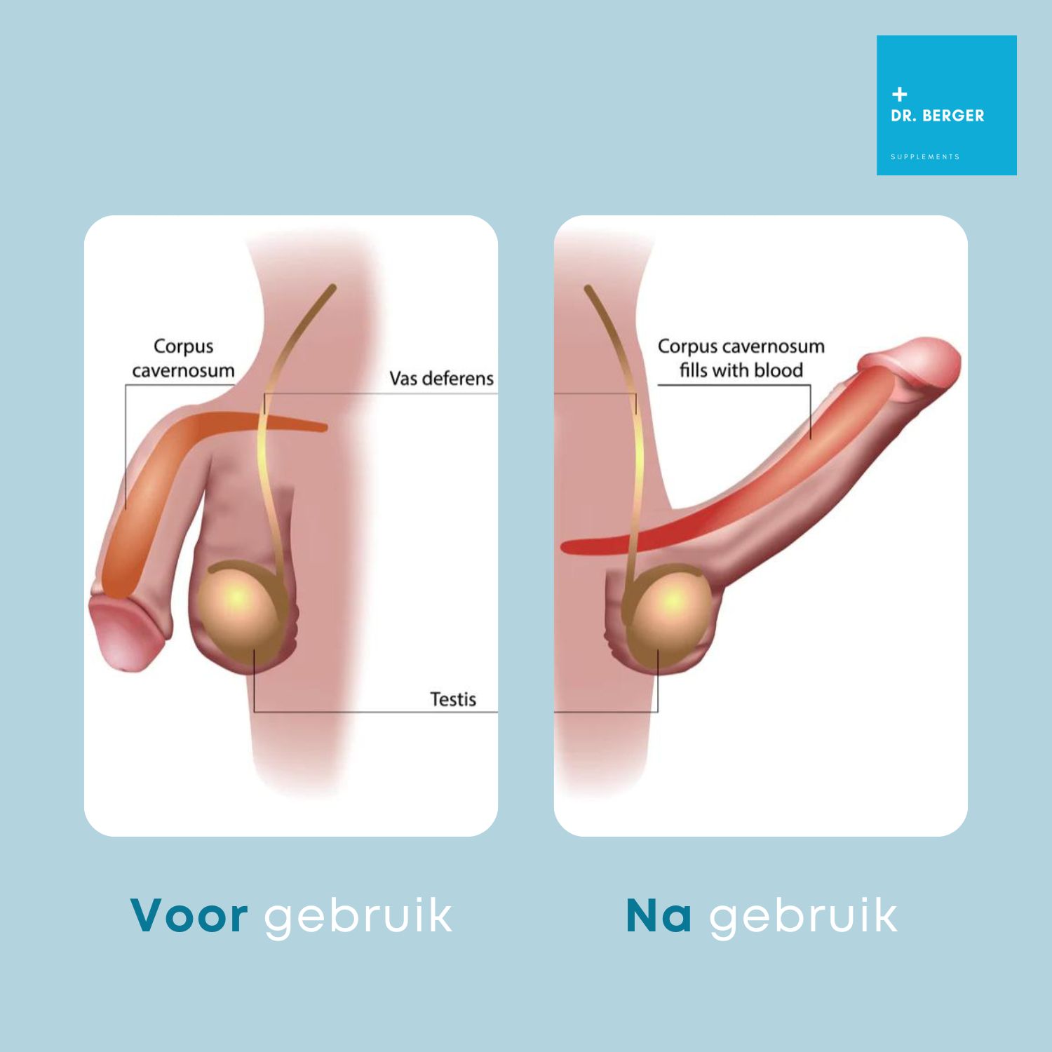 Twee diagrammen. Voor en na gebruik. Weergave van de penis. Opschrift: Corpus cavernosum, Testis.