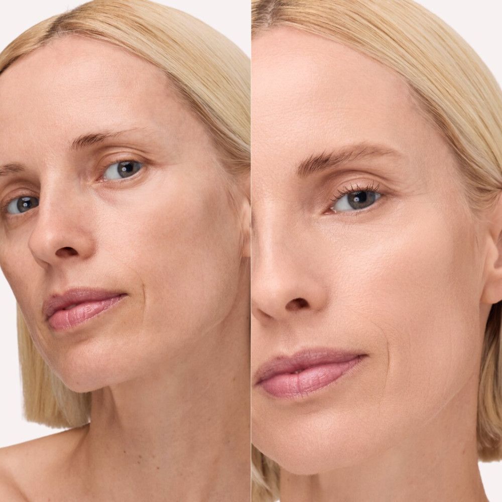 Comparaison avant-après. Femme blonde. Gauche: sans maquillage. Droite: visage avec hydratant teinté.