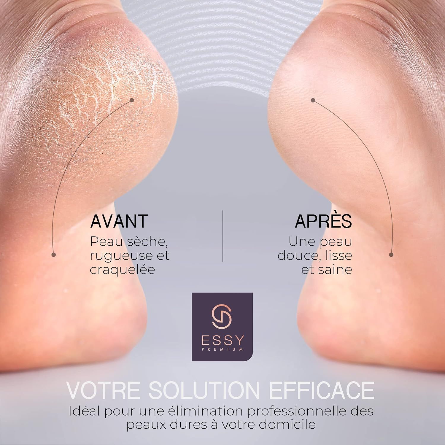 Comparaison avant-après de la peau sèche et craquelée du talon. Montre l'amélioration après utilisation.