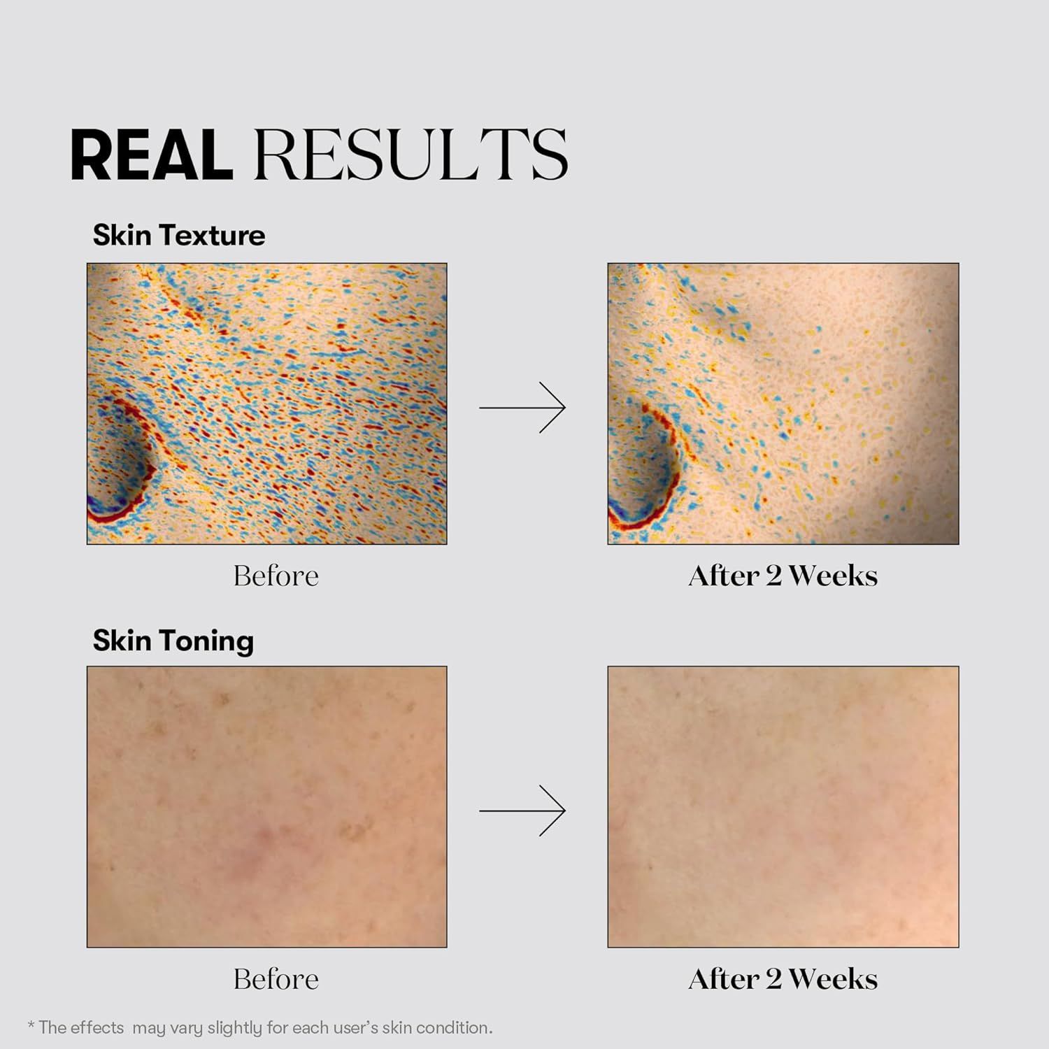 Comparaison avant-après. Texture de la peau et tonification de la peau. Les images montrent les changements après 2 semaines. Texte: Real Results.