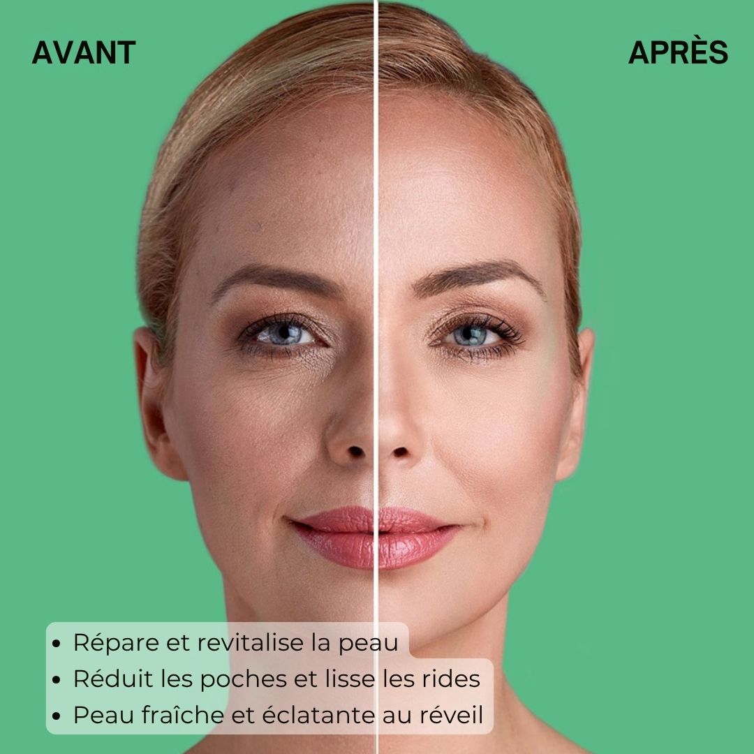Image avant-après d'une femme. Texte : Régénère, réduit les poches, lisse les rides.