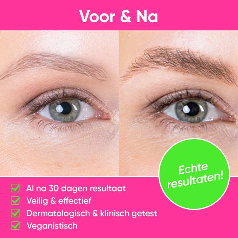Voor-en-na vergelijking van wenkbrauwen behandeld met LUXE BROW serum. Resultaten in 30 dagen, veilig, effectief, vegan.