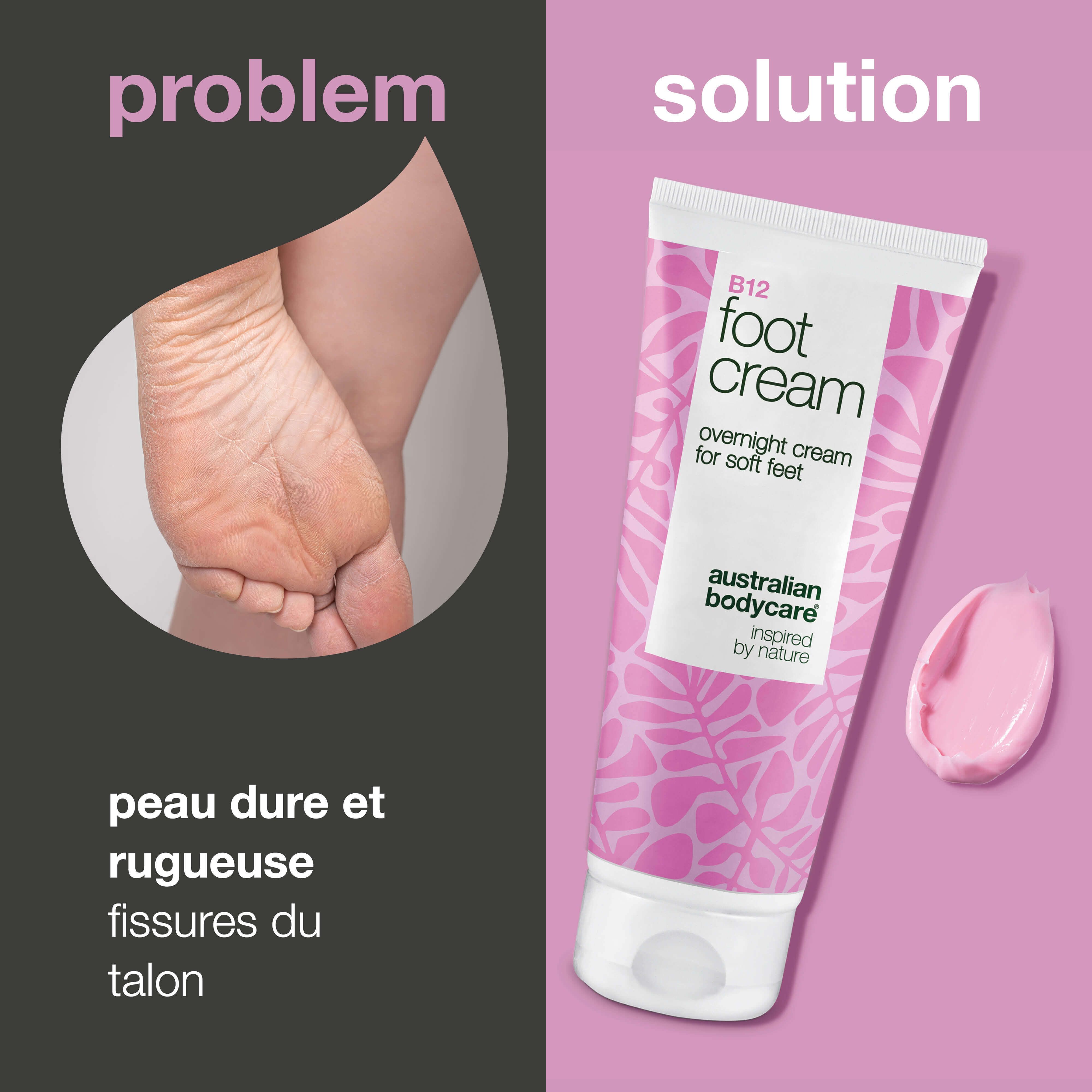 Comparaison: talon rugueux vs. B12 Foot Cream. Tube rose. Goutte de crème rose. Texte: B12 Foot Cream, crème de nuit.