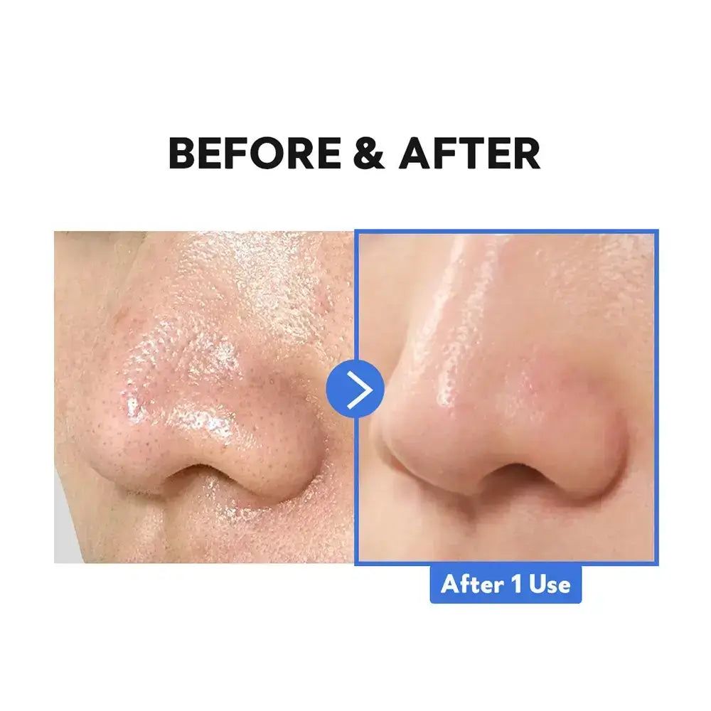Comparaison avant-après des pores du nez, affinés après utilisation du TIRTIR Hydro Boost Enzyme Cleansing Balm.
