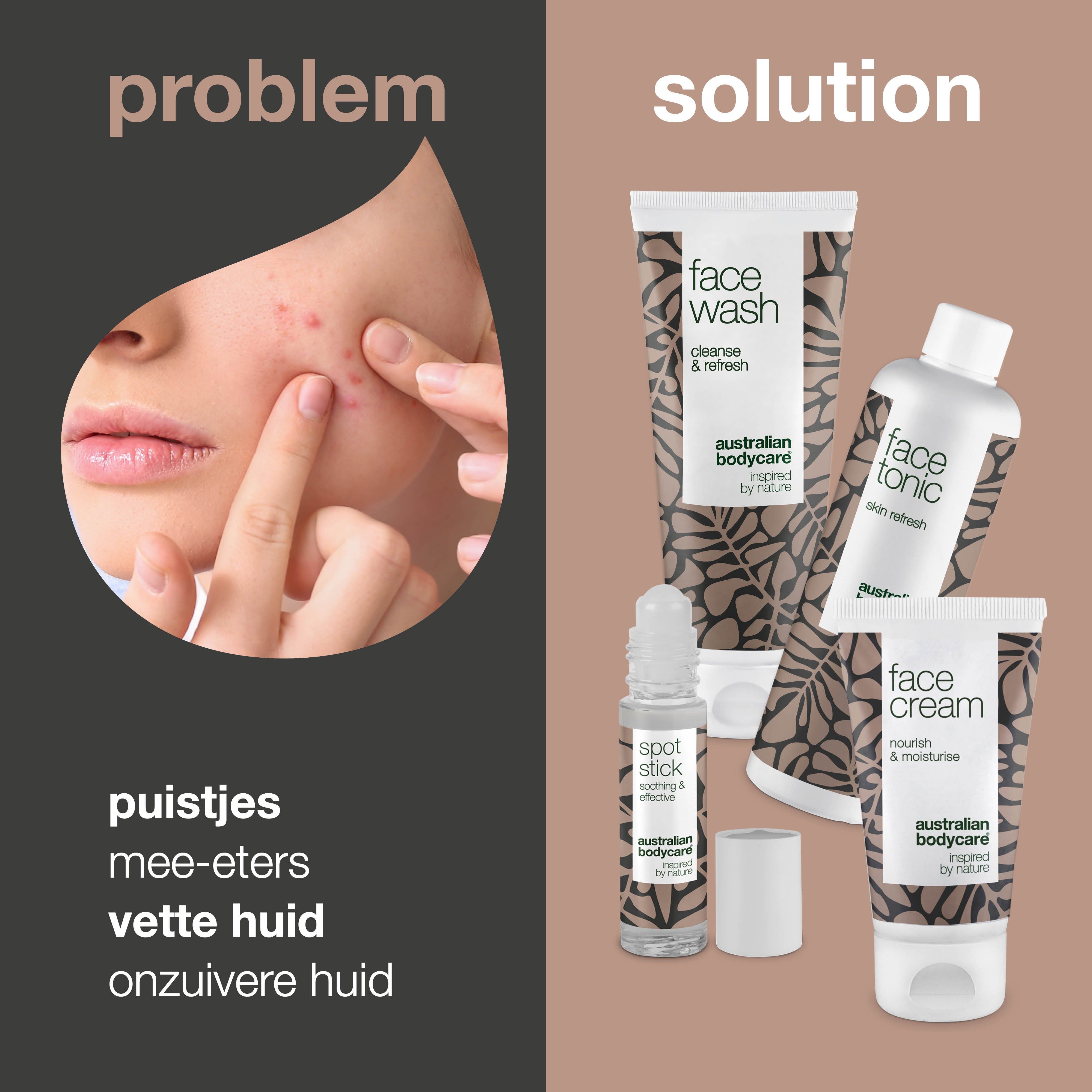 Gezicht met puistjes. Daarnaast vier producten: Face Wash, Face Tonic, Face Cream en Spot Stick. Tekst: puistjes, mee-eters, vette huid.